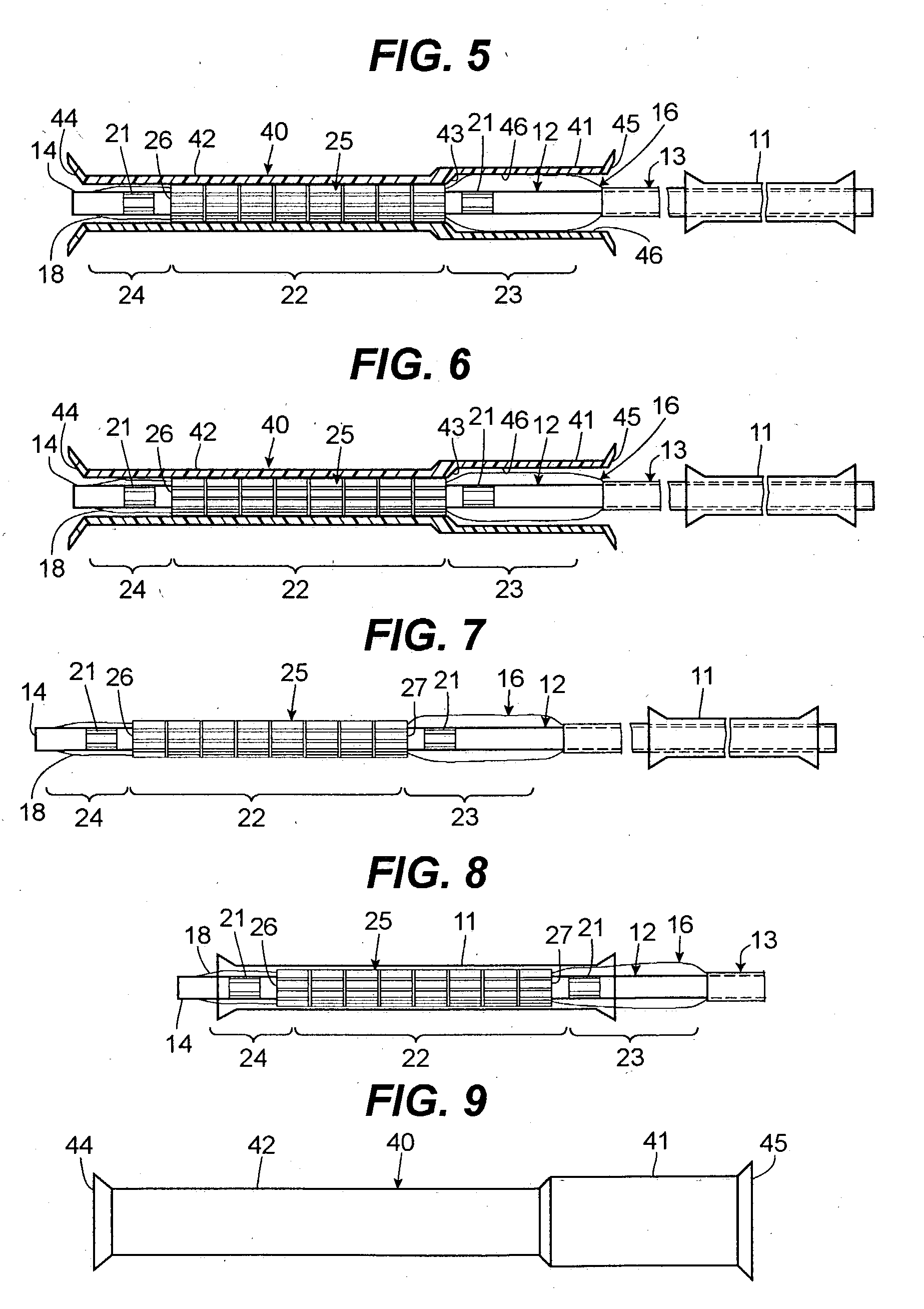 Asymmetric stent delivery system with proximal edge protection and method of manufacture thereof