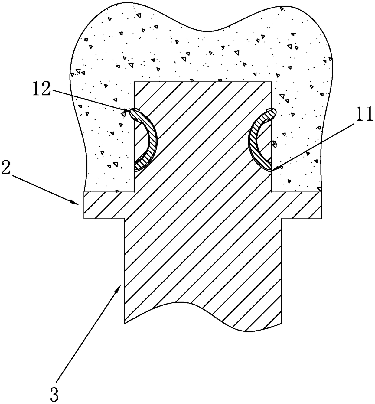 Zirconia base station