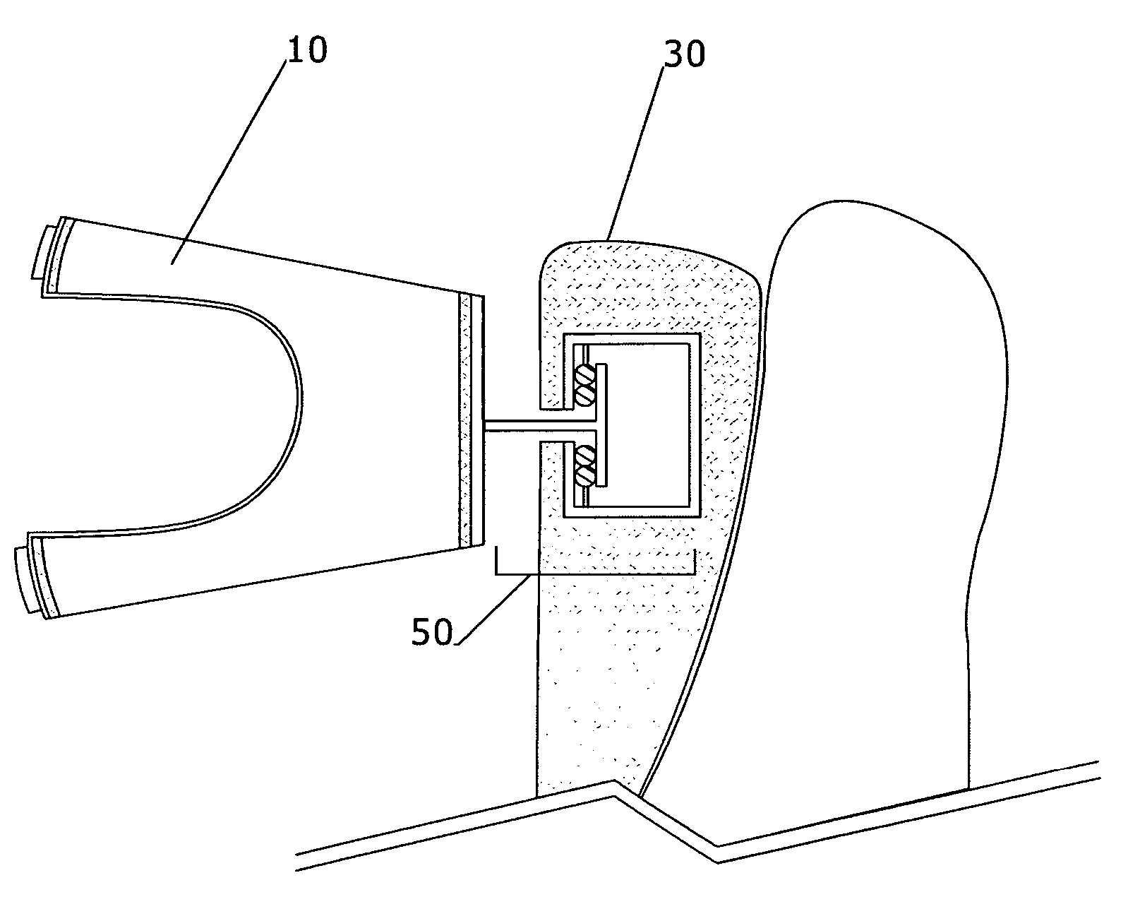 Whiplash restrainer