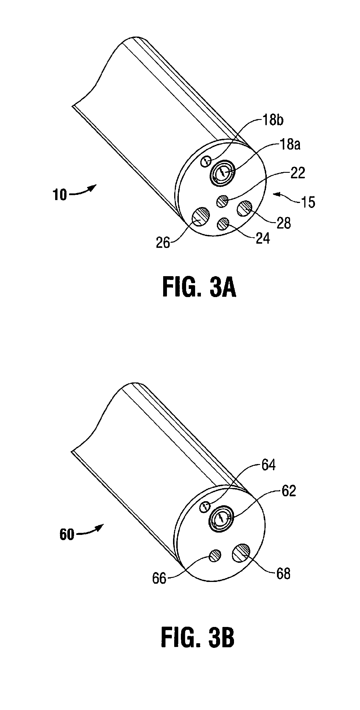 Gastric bypass system and method