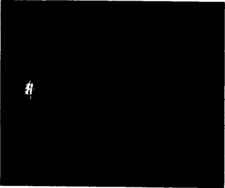 Coculturing fermentation method of rhizobium and Bacillus phosphorus