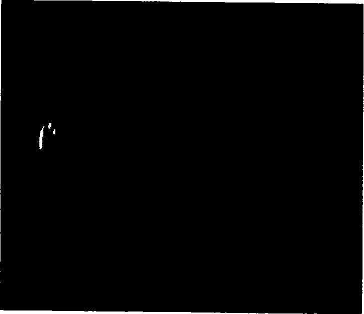 Coculturing fermentation method of rhizobium and Bacillus phosphorus