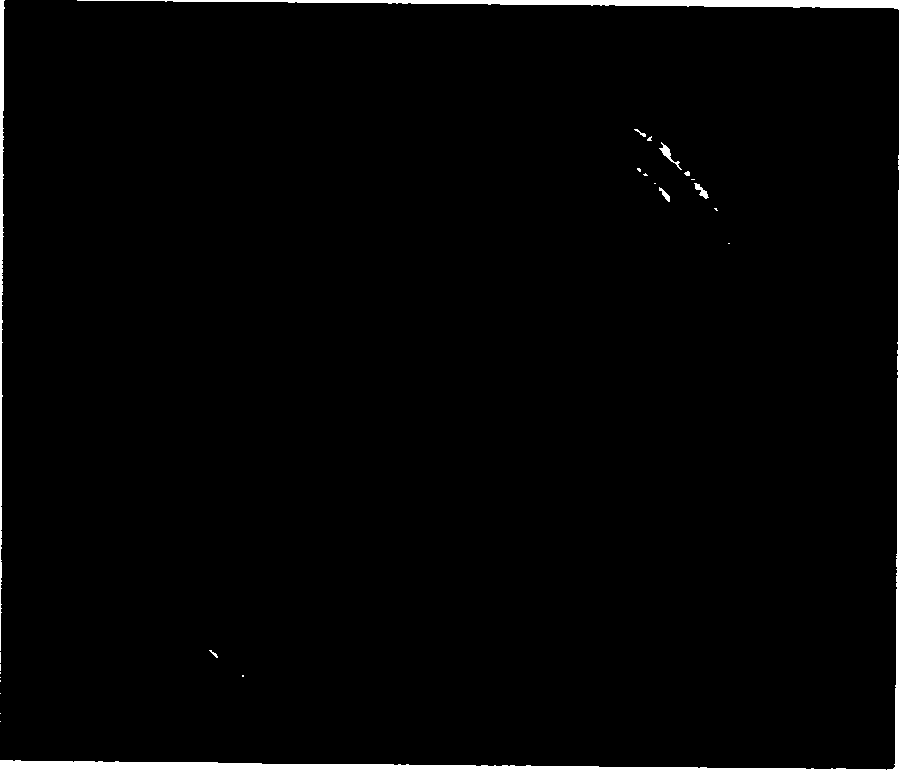 Coculturing fermentation method of rhizobium and Bacillus phosphorus