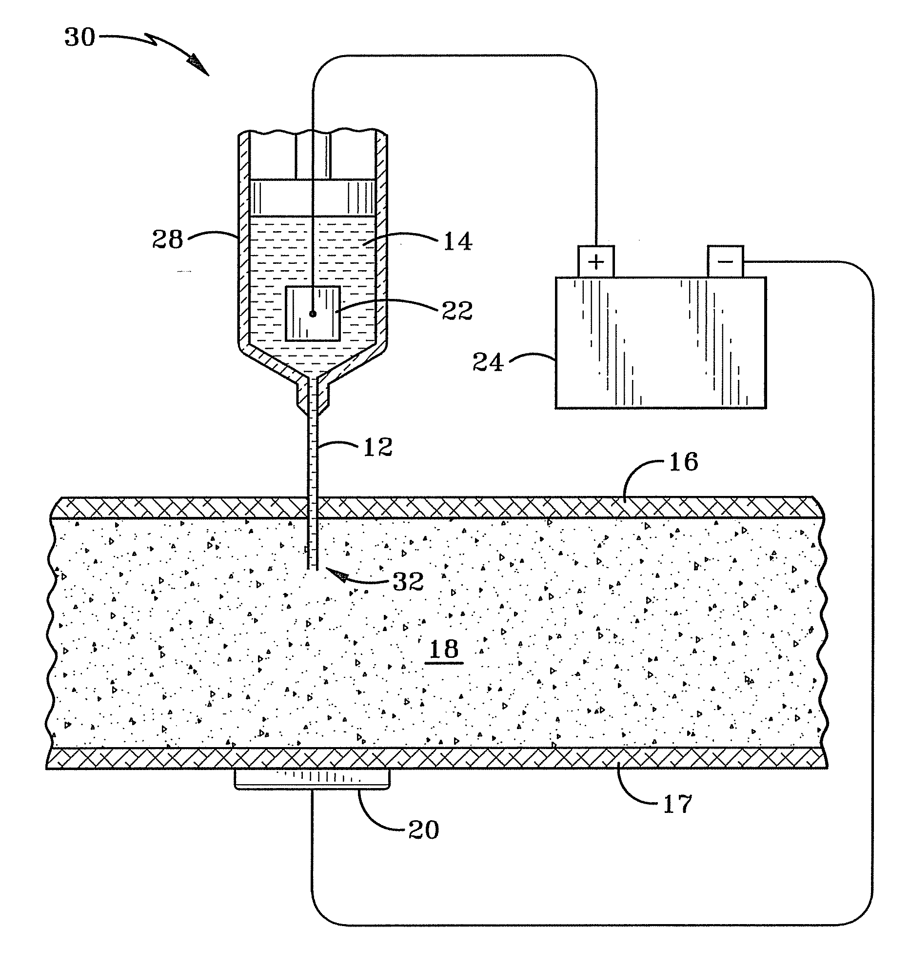 Iontophoretic delivery system