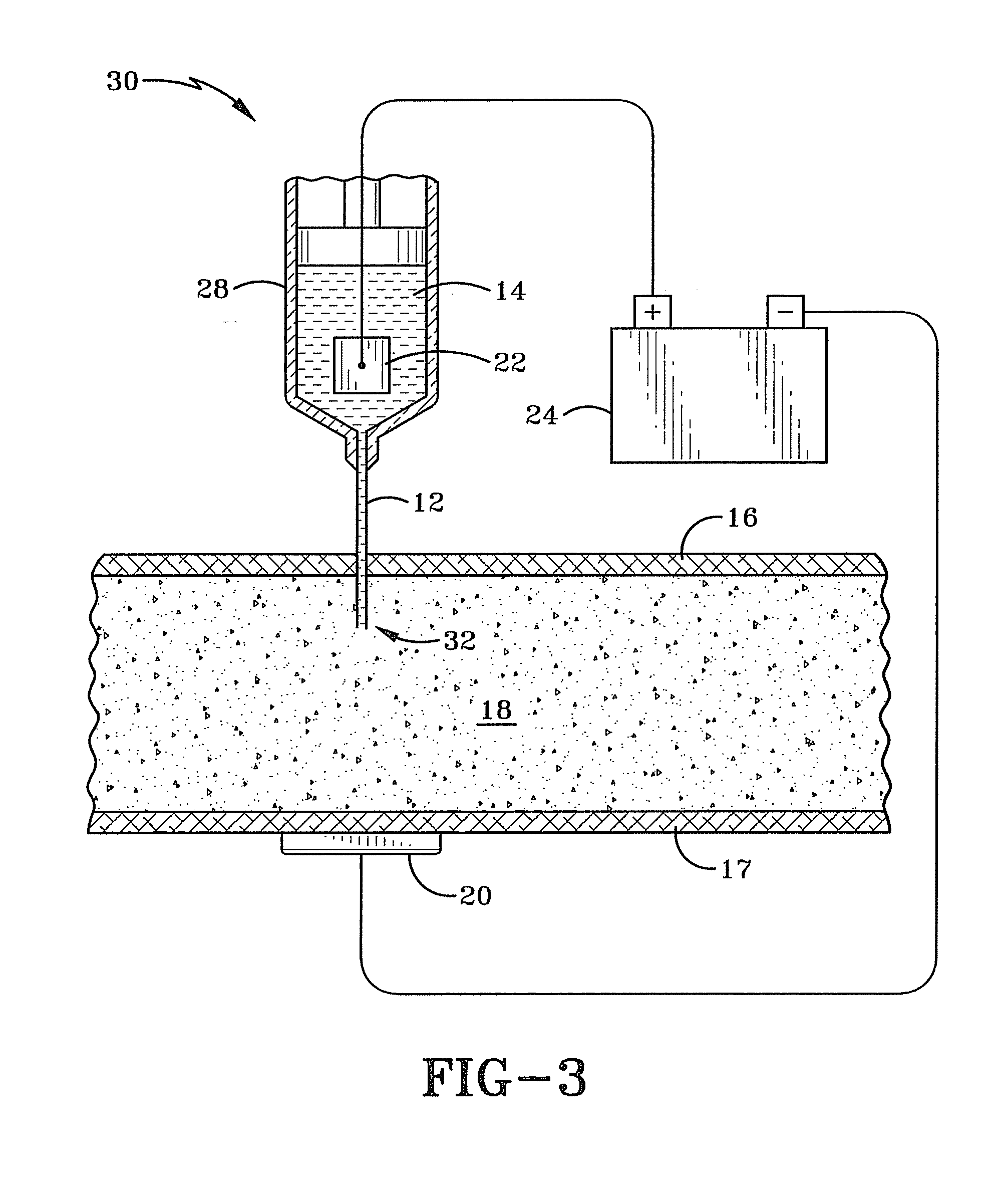 Iontophoretic delivery system