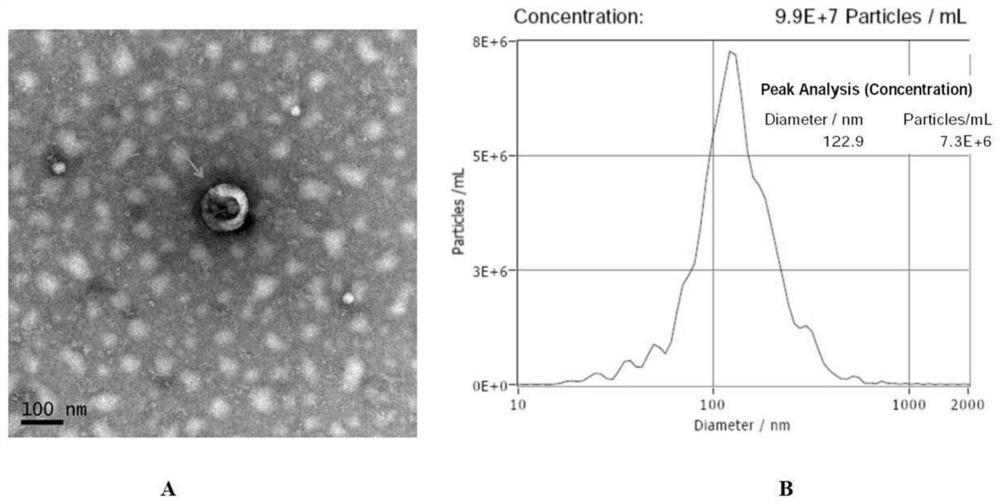 Acute myocardial infarction biomarker and application thereof