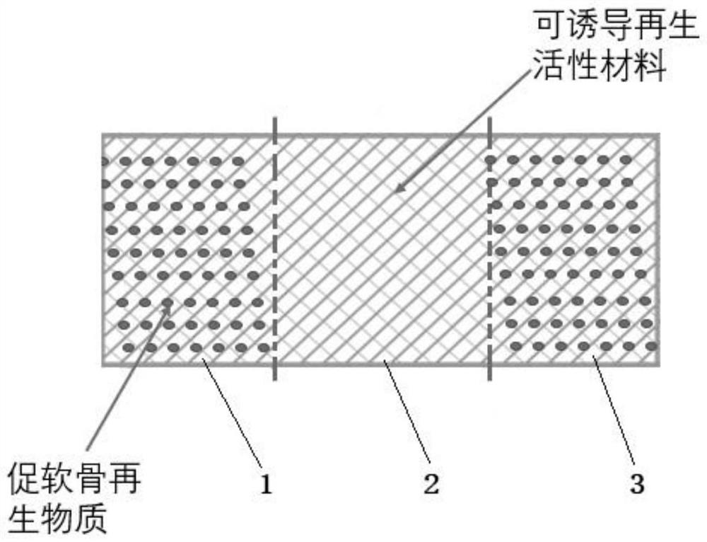 Paging ligament regeneration enhancing stent and preparation method thereof