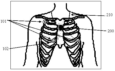 Dynamic electrocardiogram and motion recording and analyzing system