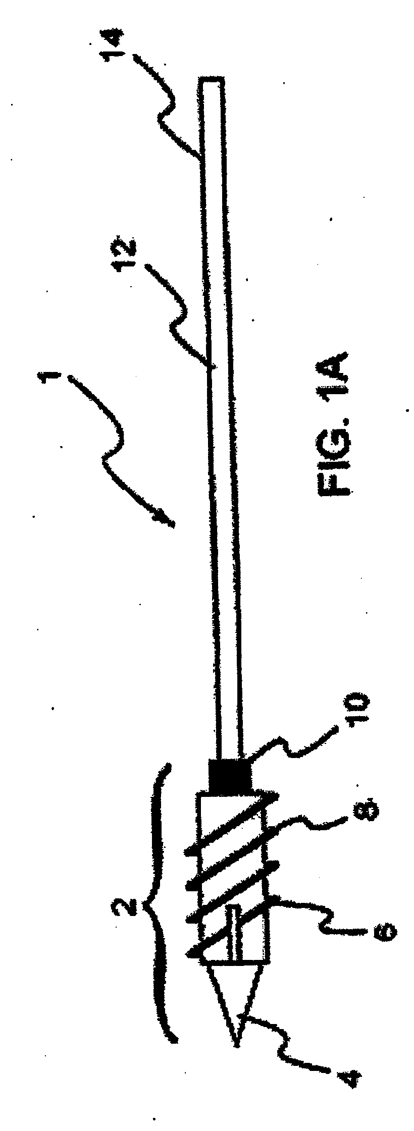 System and method for the fixation of bone fractures