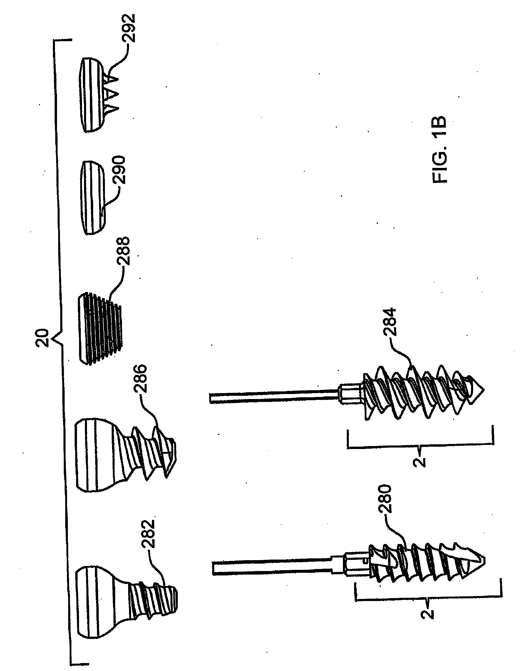 System and method for the fixation of bone fractures