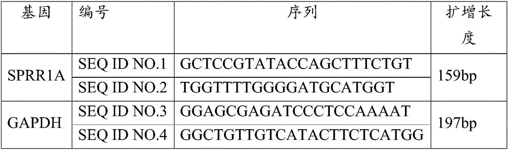 Application of SPRR1A gene in preparation of osteoarthritis diagnosis product