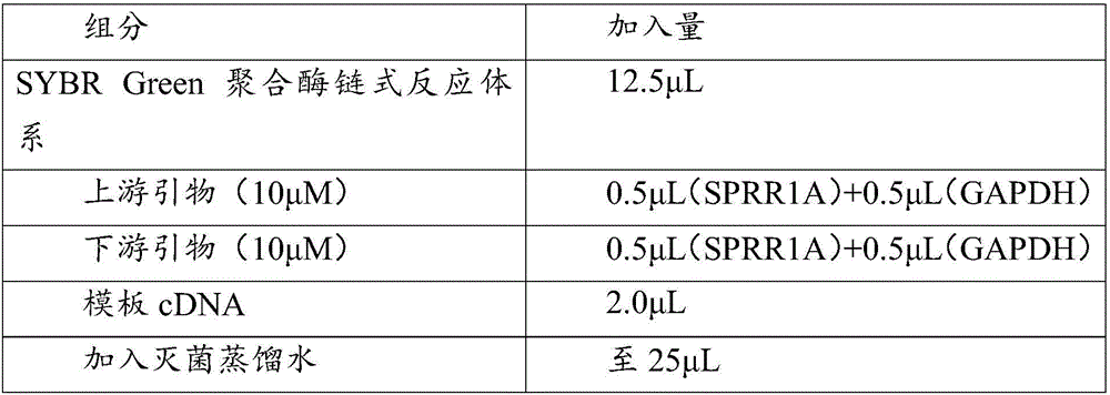 Application of SPRR1A gene in preparation of osteoarthritis diagnosis product