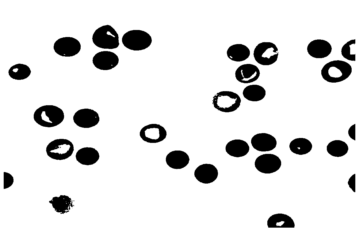 Reticulocyte classification counting model construction method and application