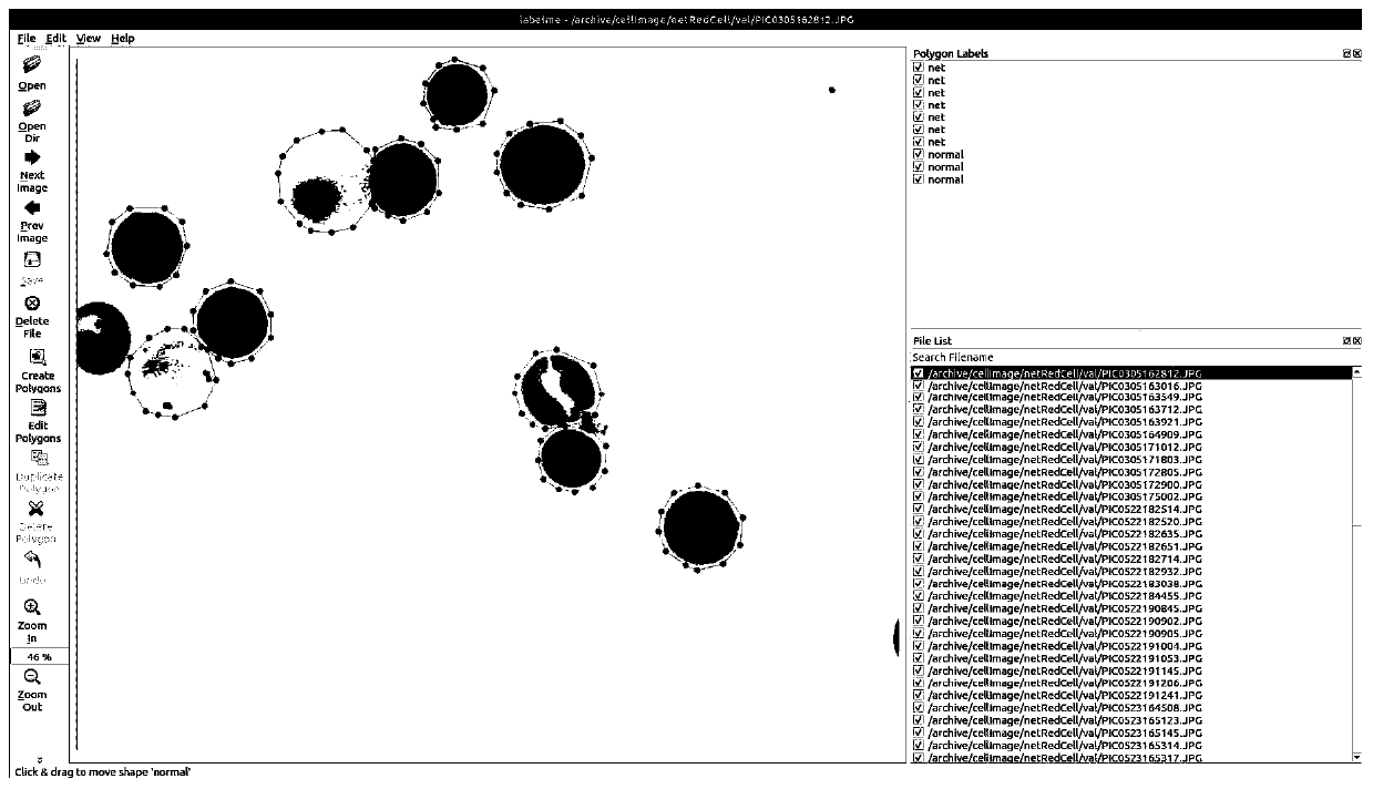 Reticulocyte classification counting model construction method and application