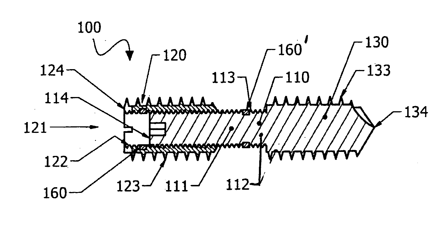 Compression bone screw