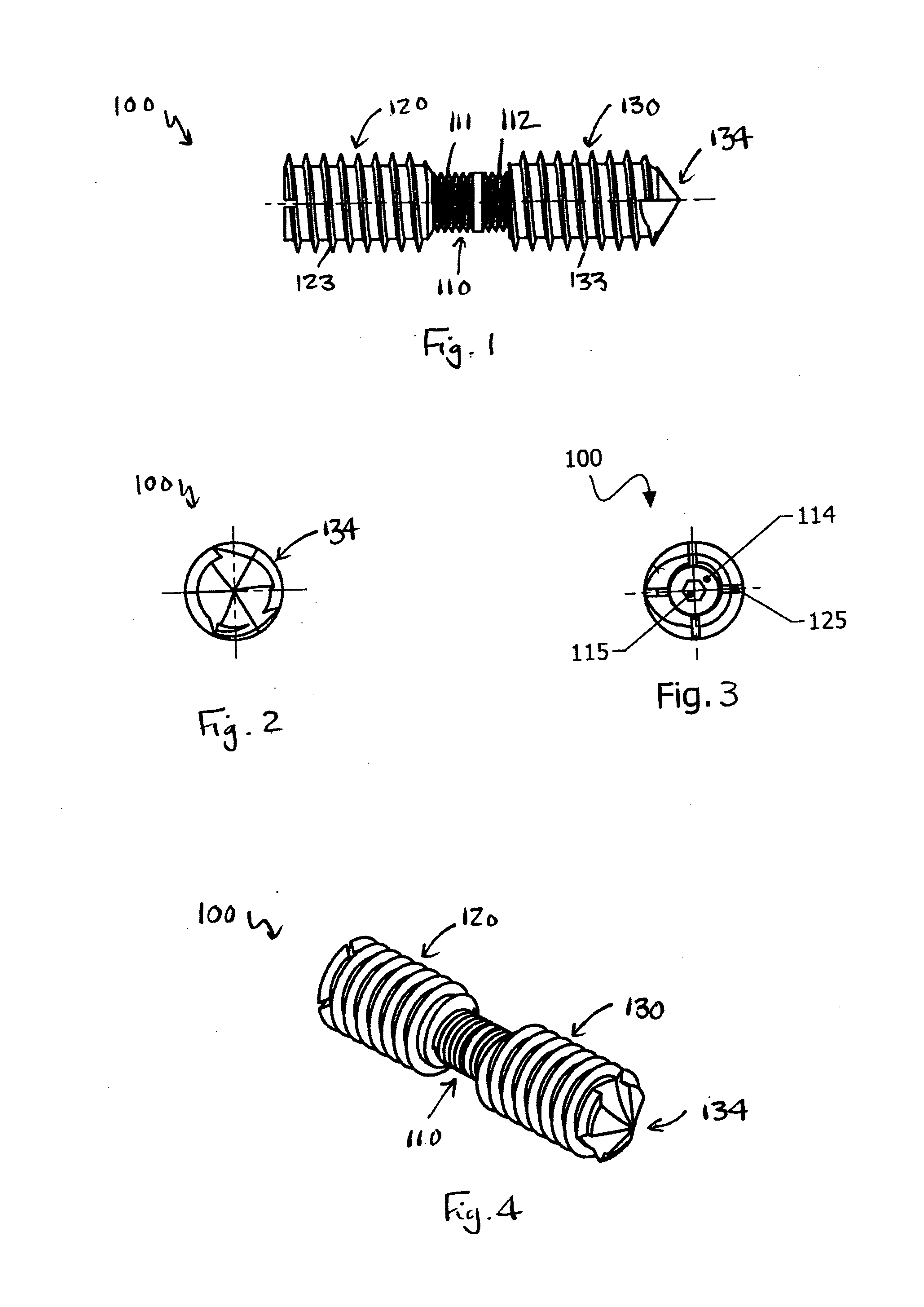 Compression bone screw