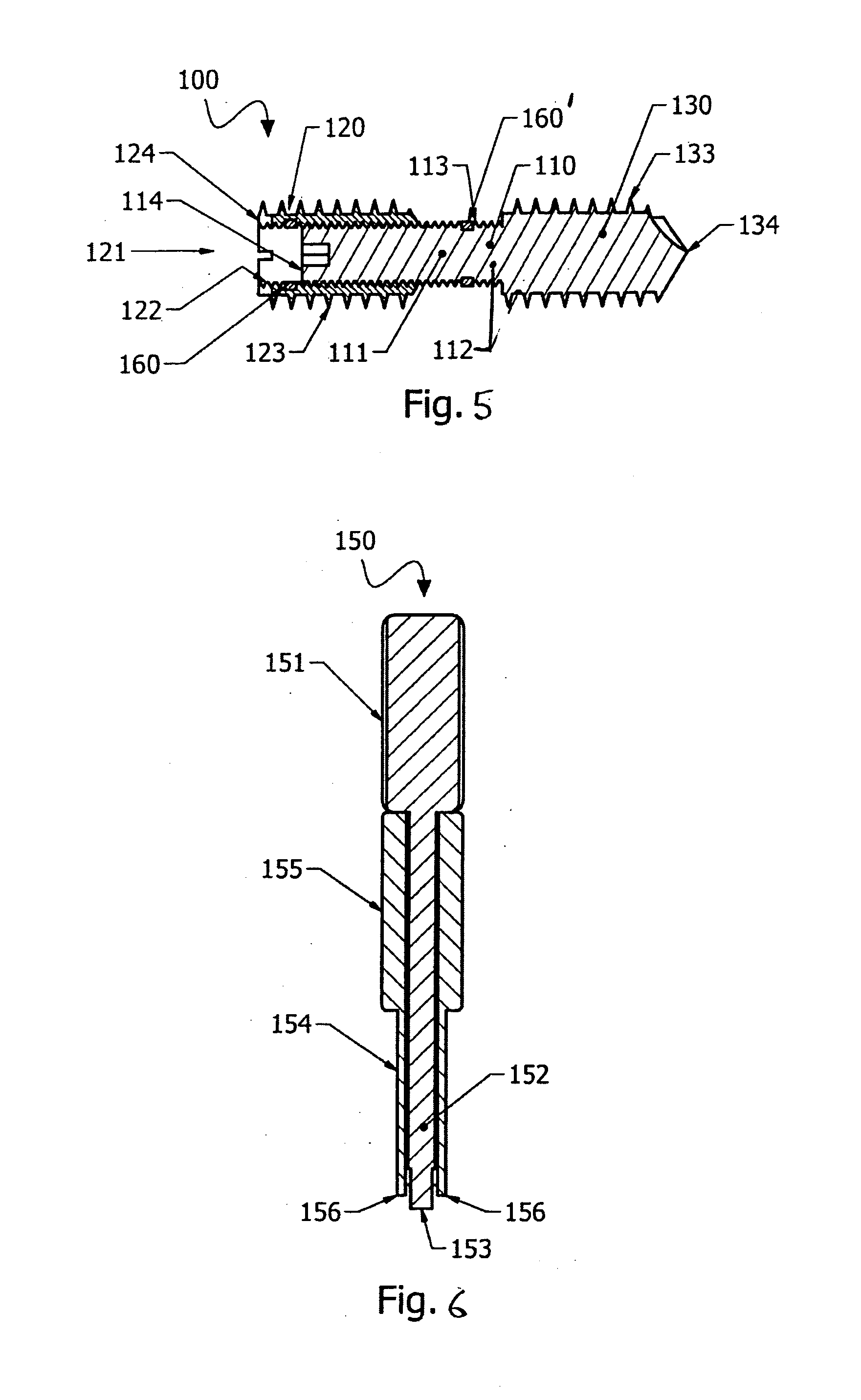 Compression bone screw