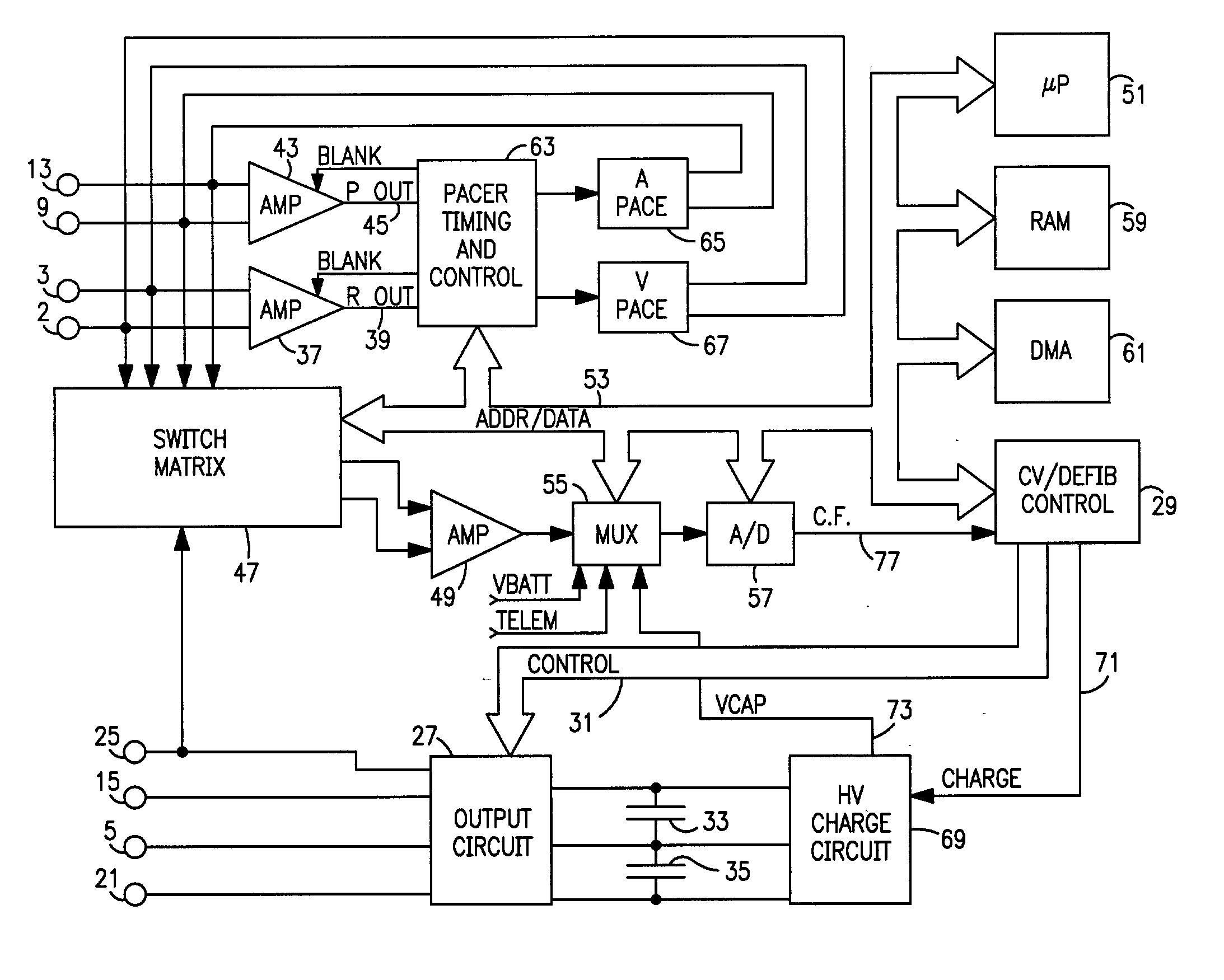 Method and system for compressing and storing data in a medical device having limited storage