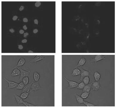 A cell membrane-coated au-fe  <sub>3</sub> o  <sub>4</sub> Targeted nanomaterials and their preparation methods and applications