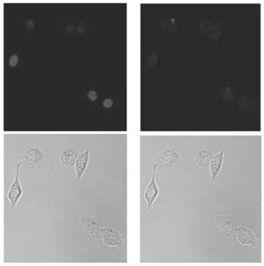 A cell membrane-coated au-fe  <sub>3</sub> o  <sub>4</sub> Targeted nanomaterials and their preparation methods and applications