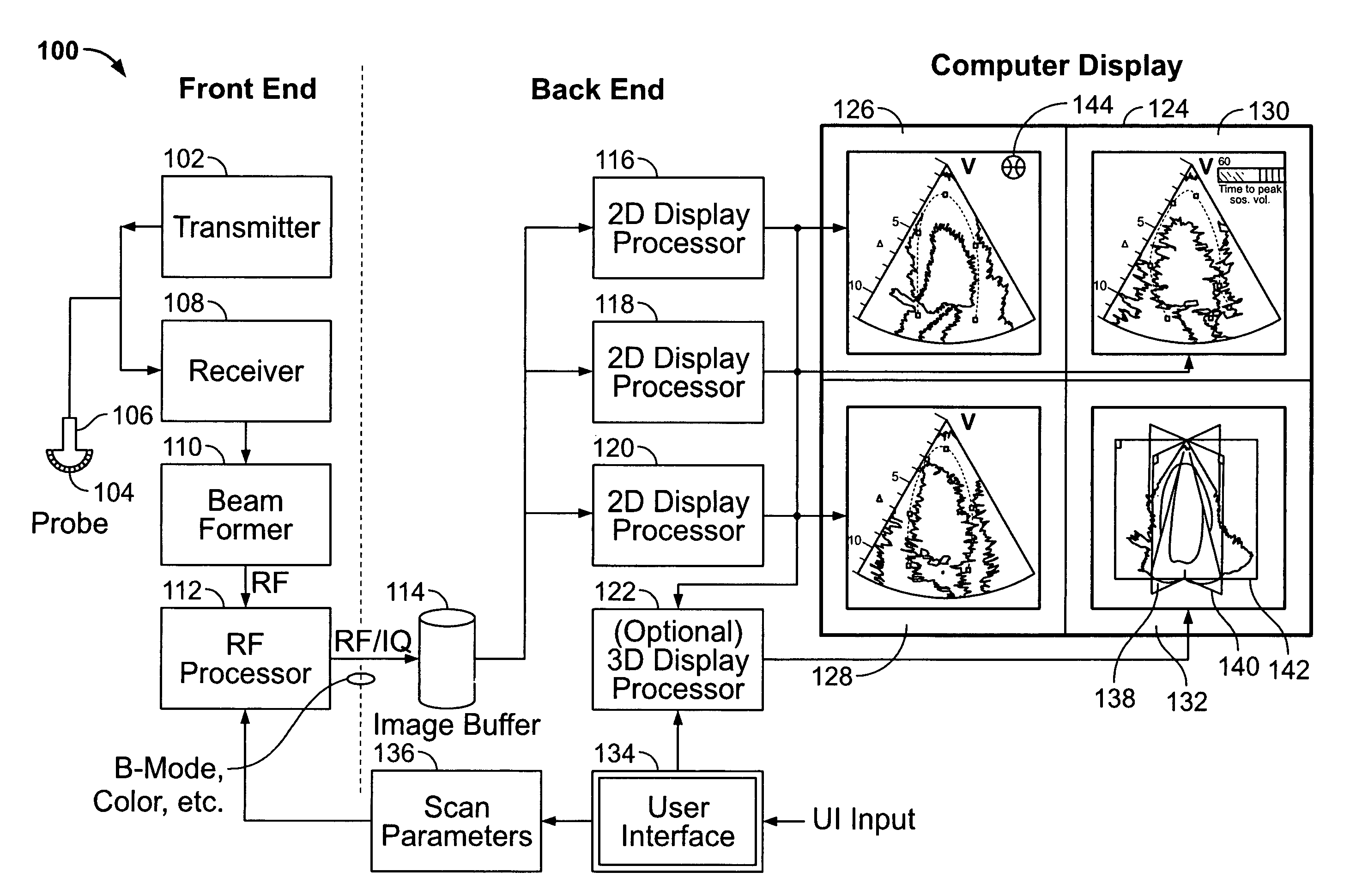 Method and apparatus for real time ultrasound multi-plane imaging