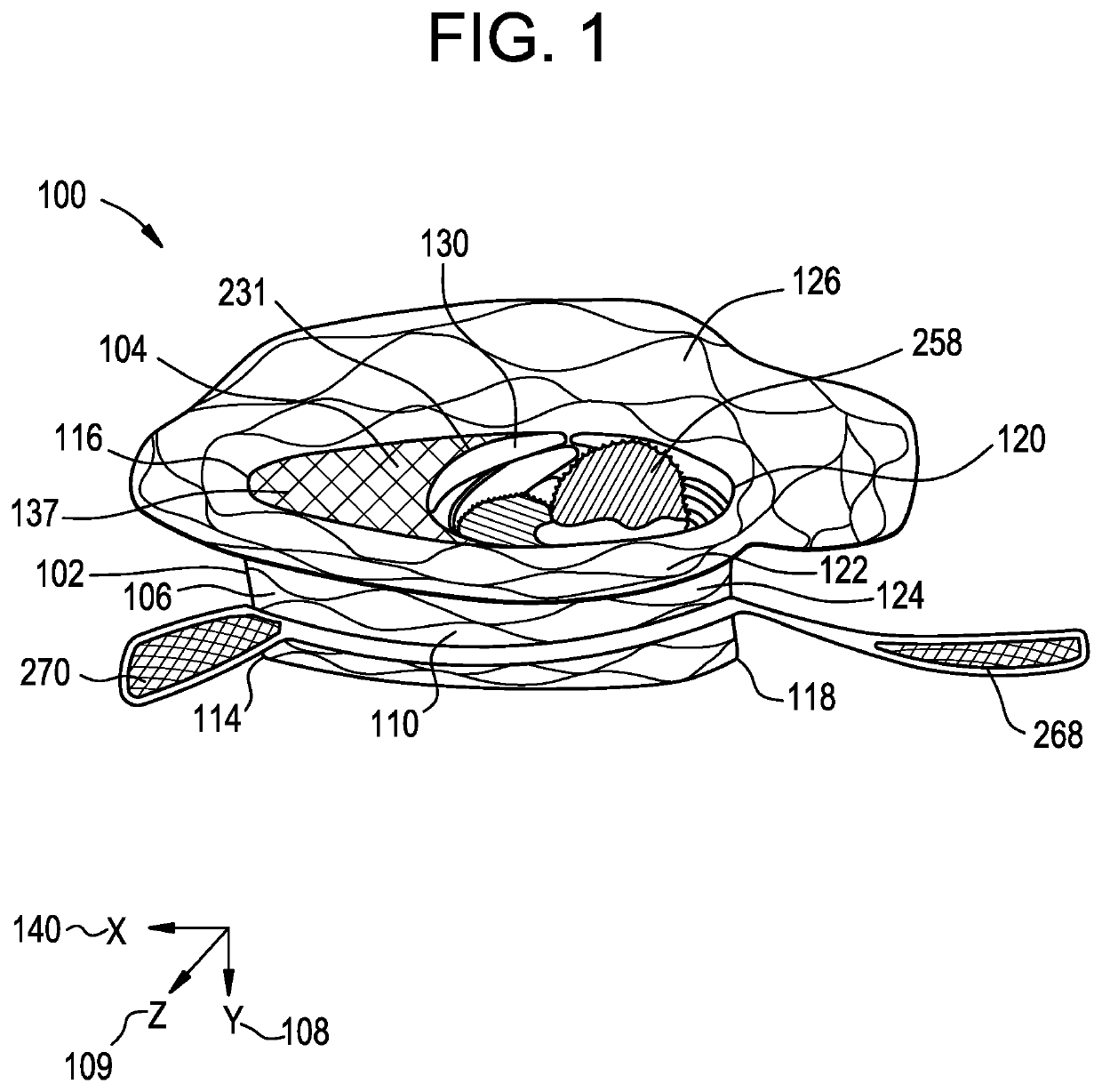 Collapsible inner flow control component for side-delivered transcatheter heart valve prosthesis