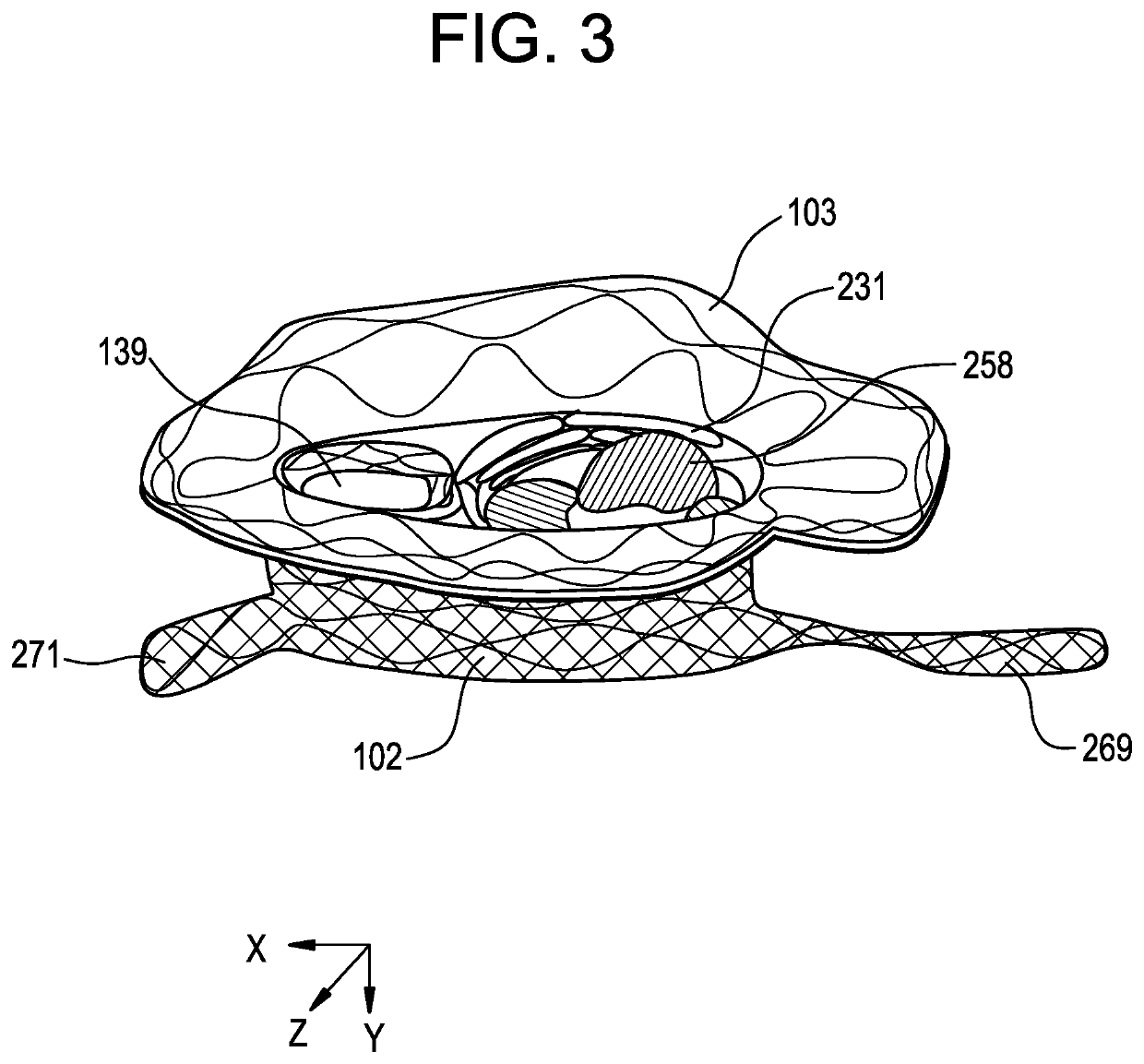 Collapsible inner flow control component for side-delivered transcatheter heart valve prosthesis