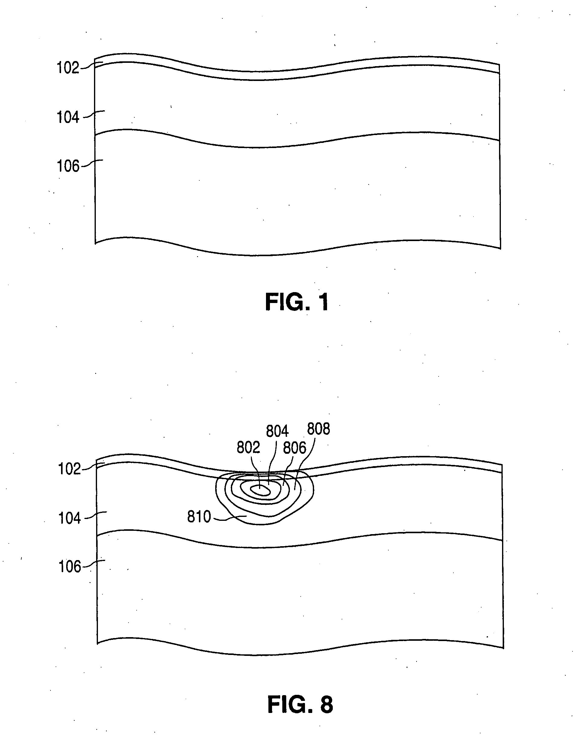 Method and system for treatment of post-partum abdominal skin redundancy or laxity