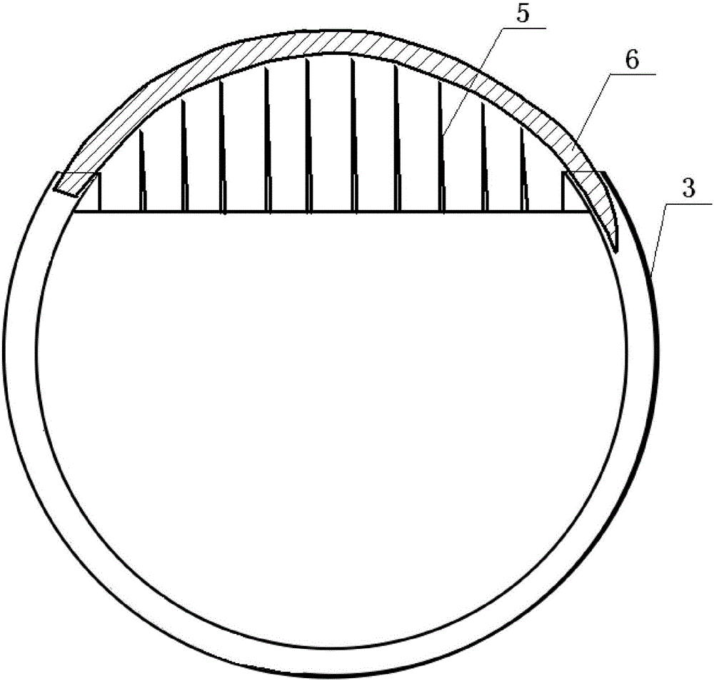 Ventricular outflow tract opener