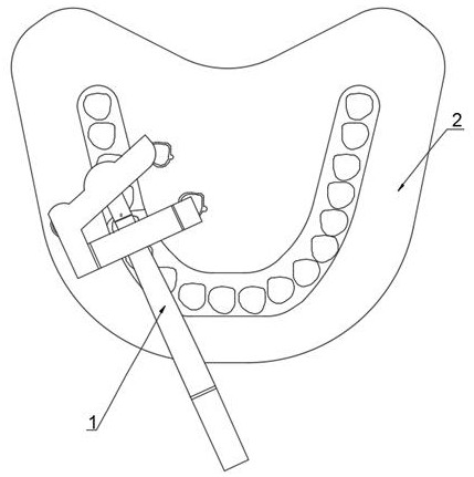 Auxiliary tool for fixing and repairing teeth and use method