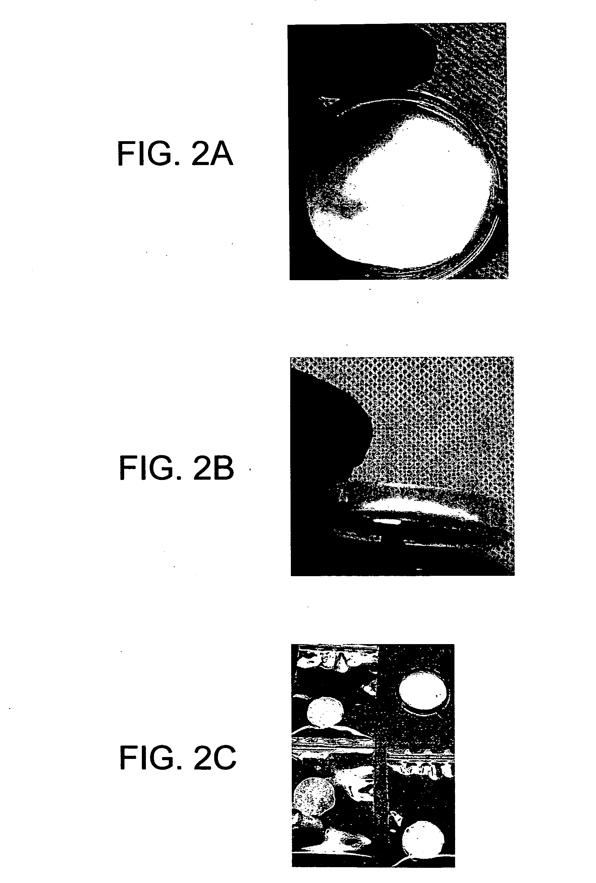 Matrix composition for human grafts/implants