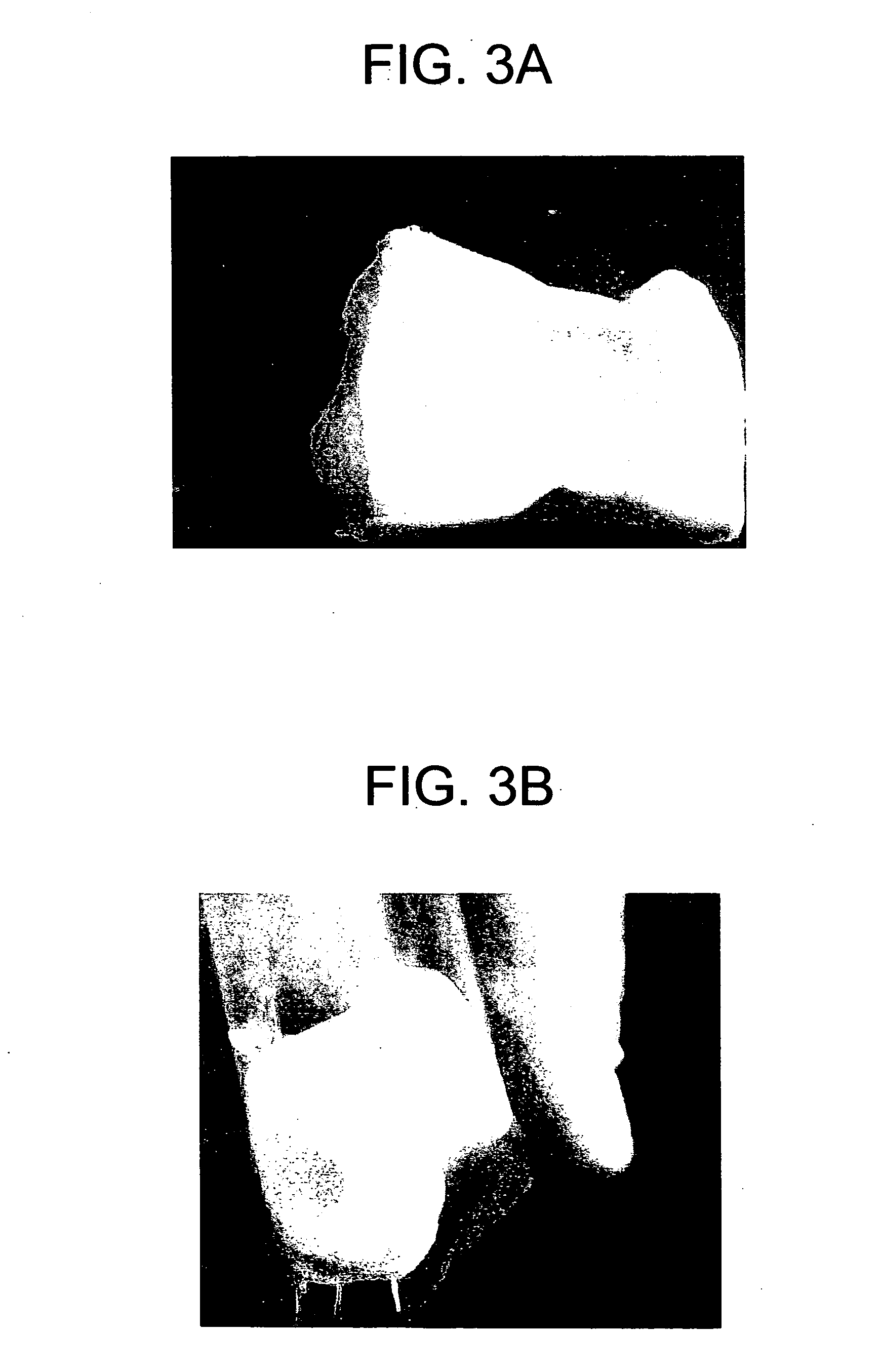 Matrix composition for human grafts/implants