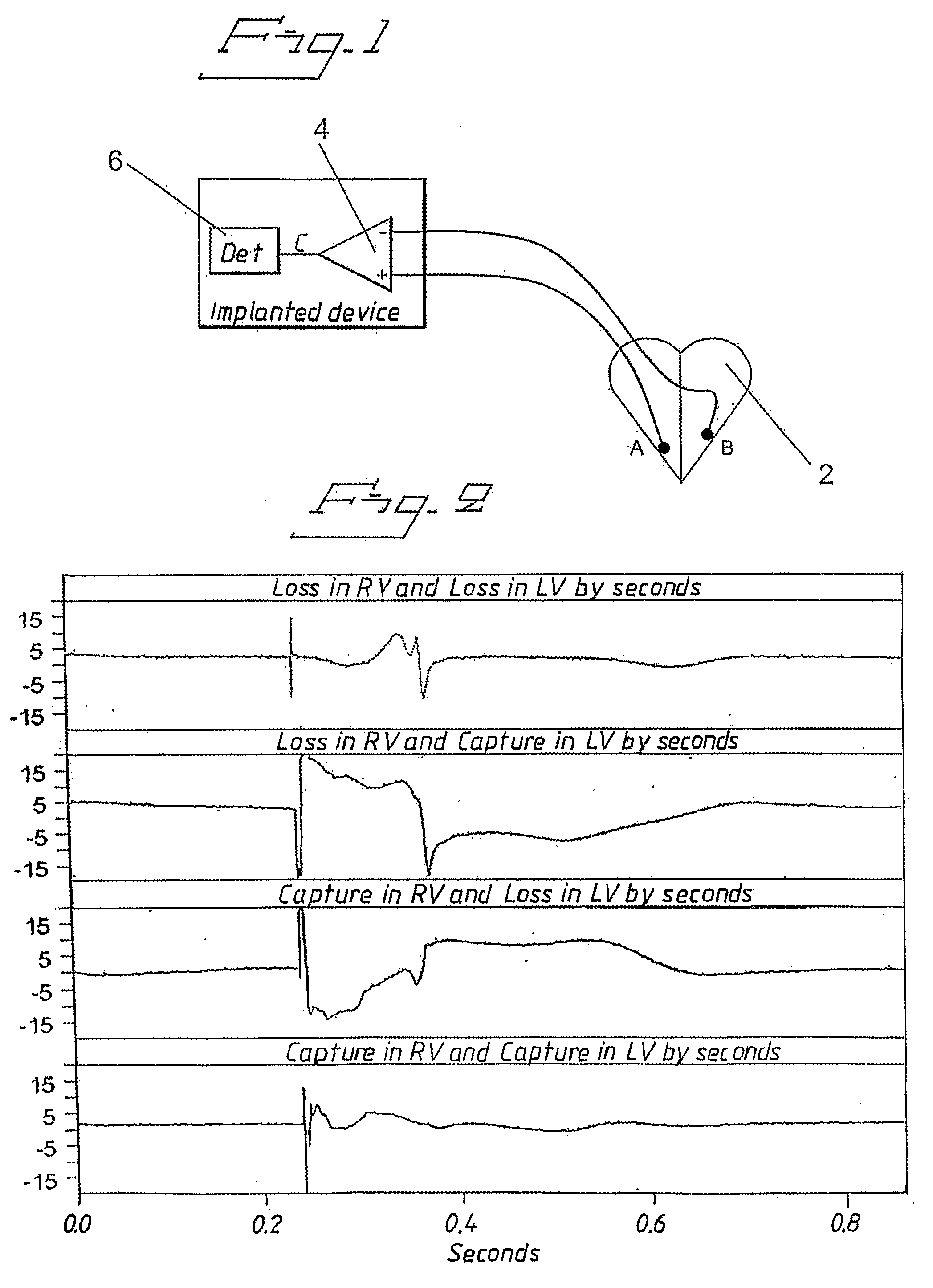 System and method for detecting electric events in chambers of a heart