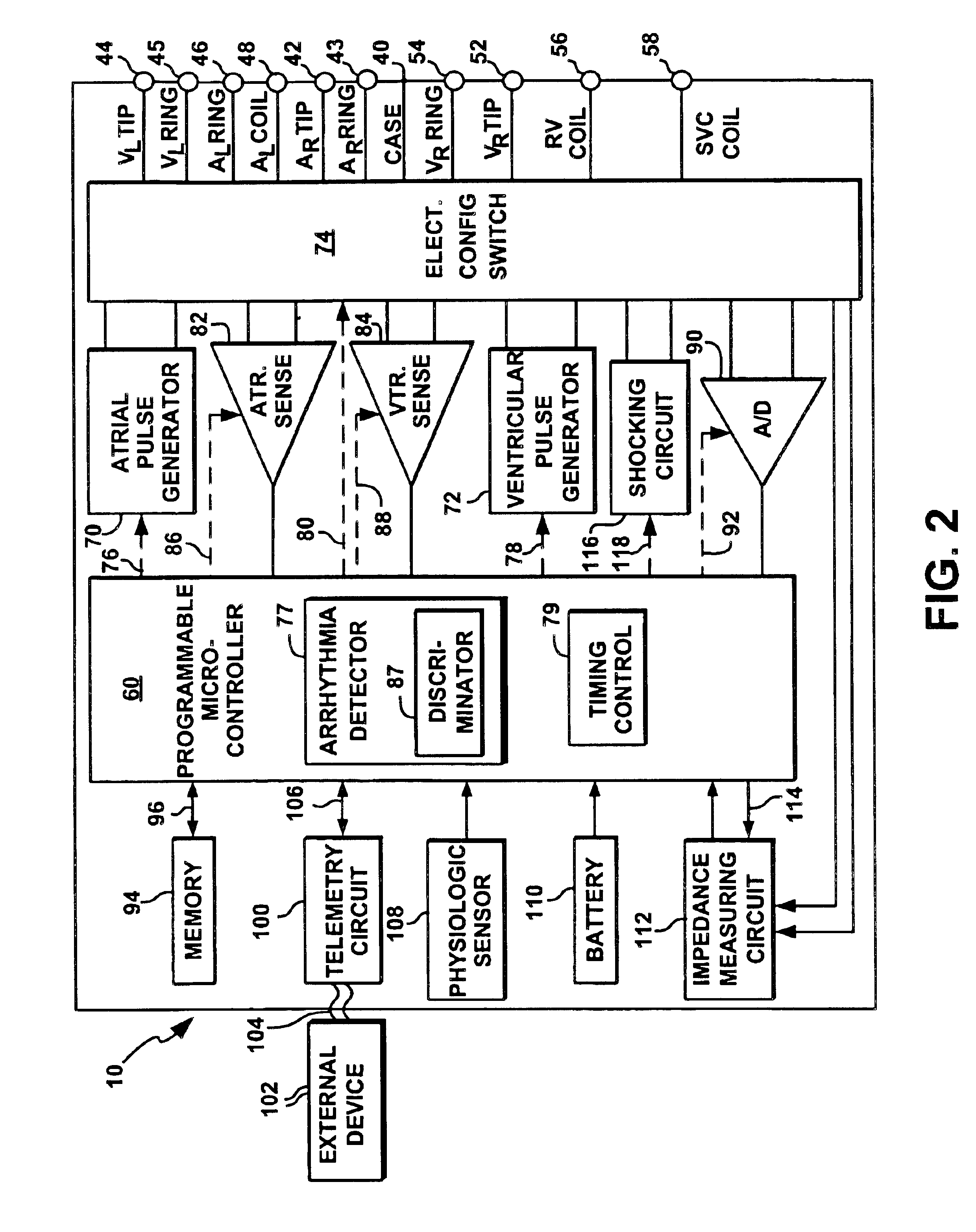 Apparatus and method for automatically sensing threshold histogram with differentiation of sinus from ectopic beats