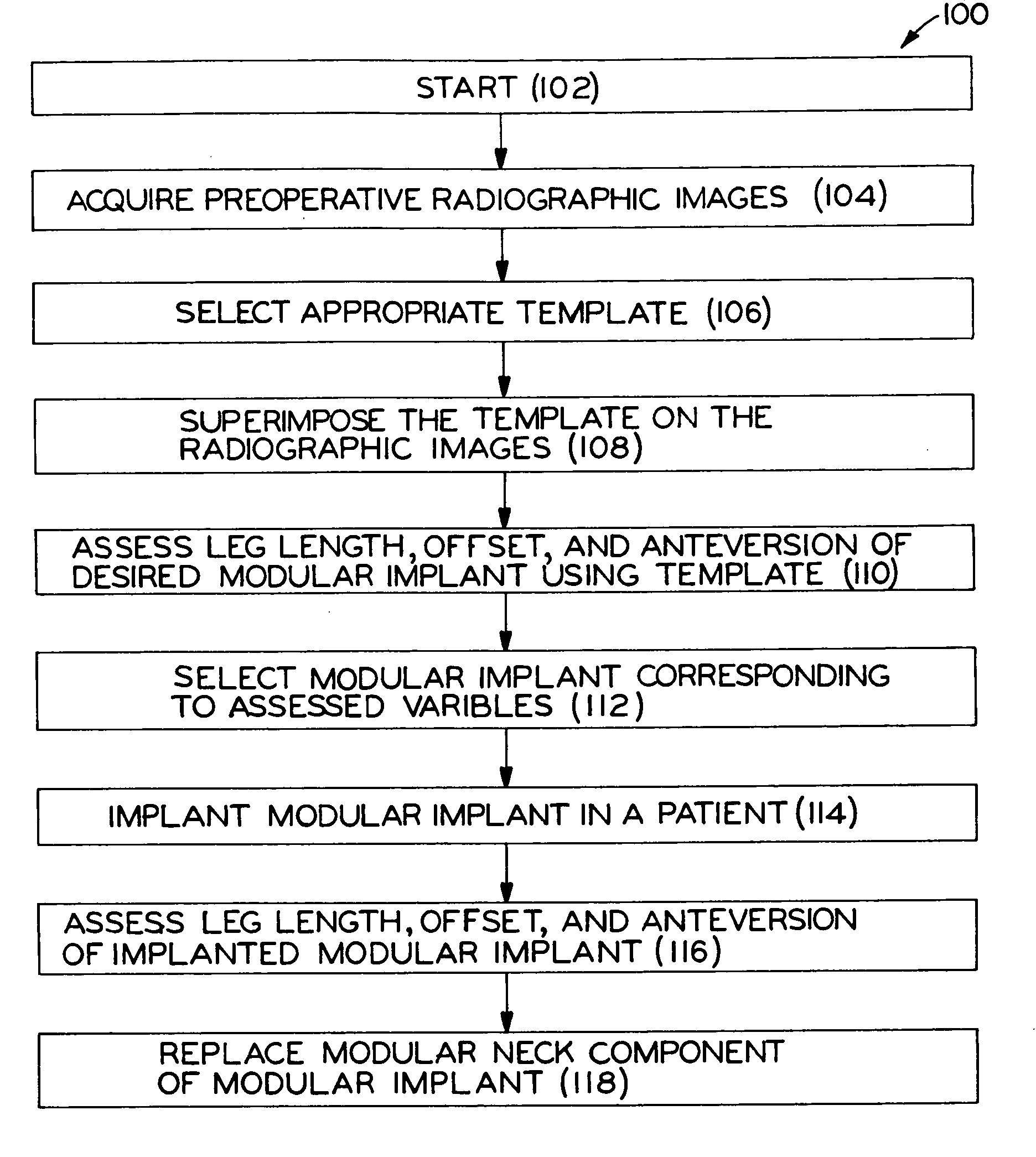 Method for selecting modular implant components