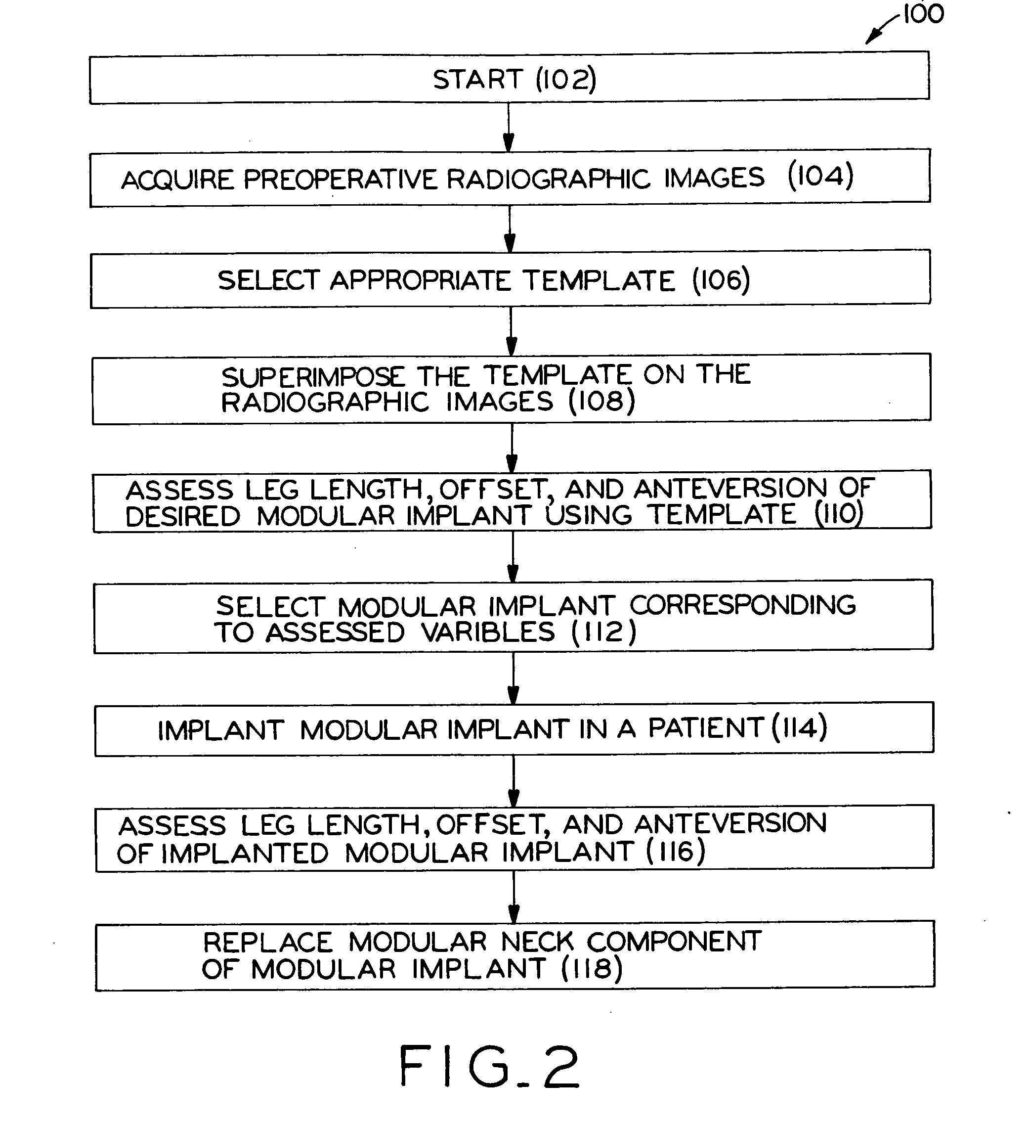 Method for selecting modular implant components