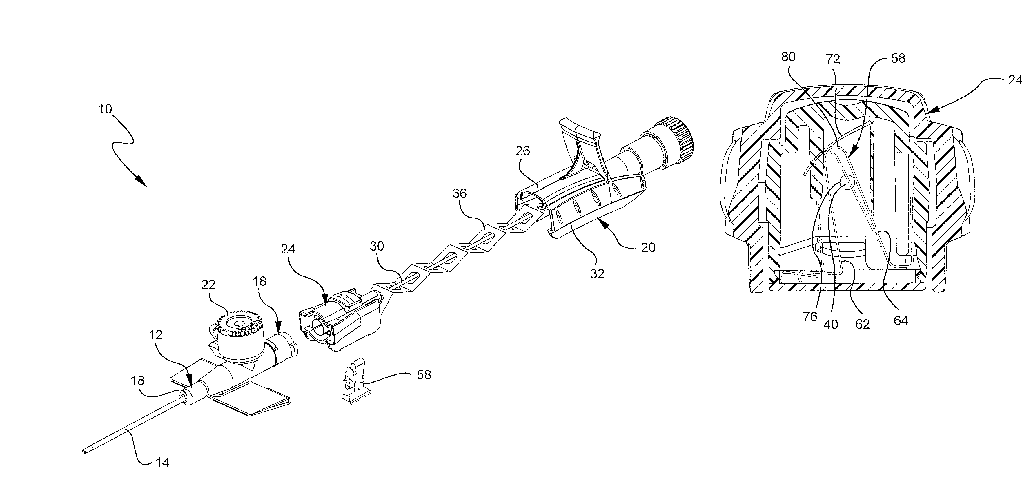 Reducing withdrawal force in a safety IV catheter