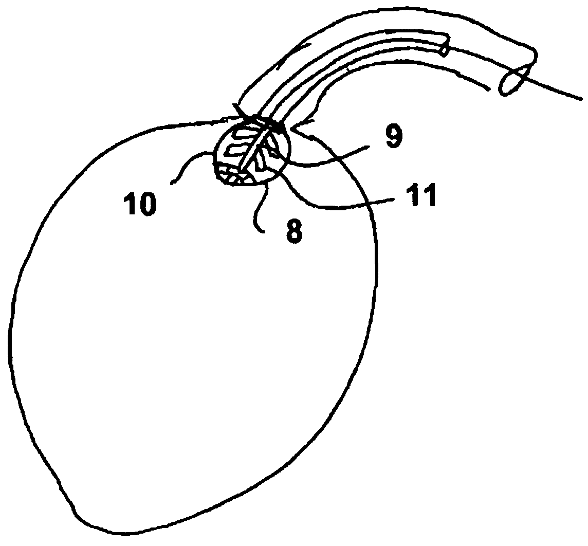 Pump device having a detection device