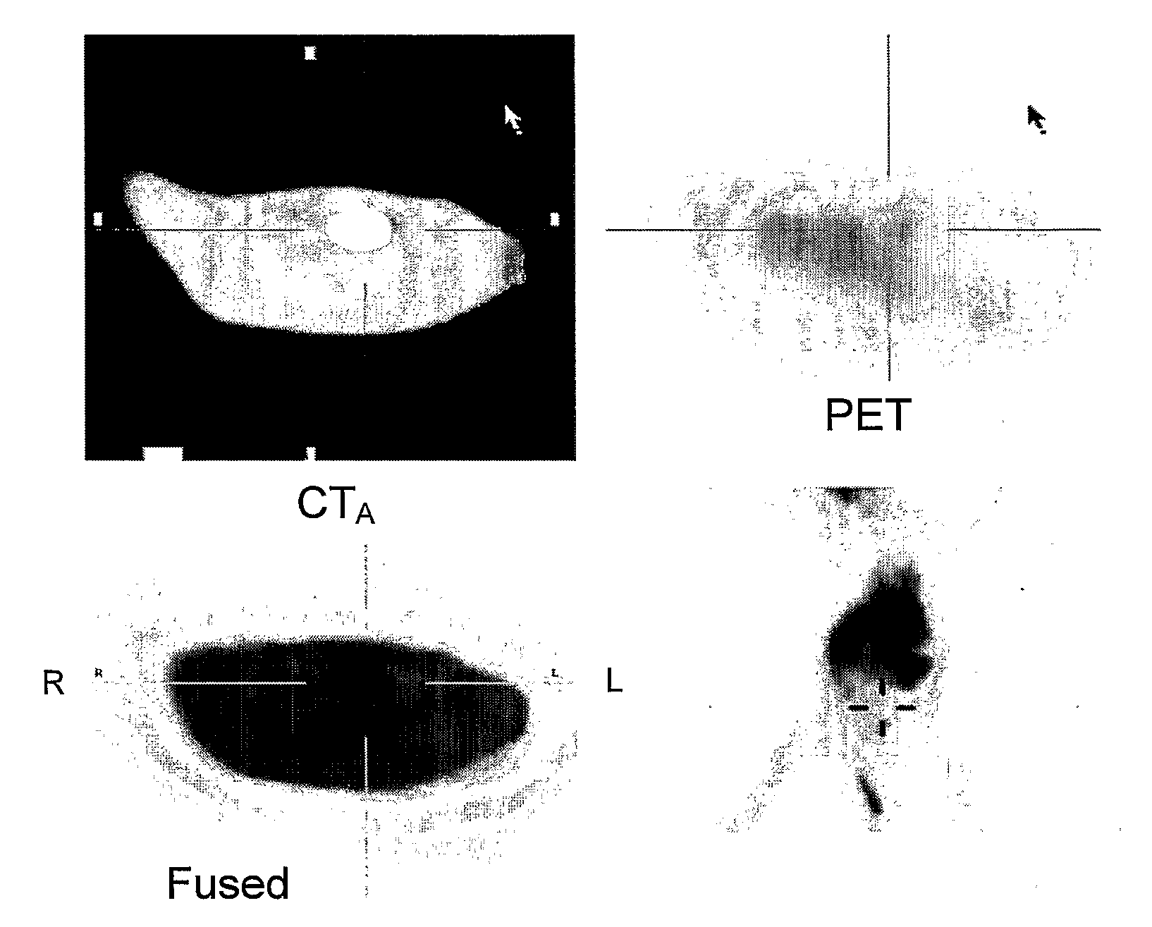 Androgen-Receptor (AR) Ligands for Use in the Treatment and Diagnosis of AR-Related Pathologies