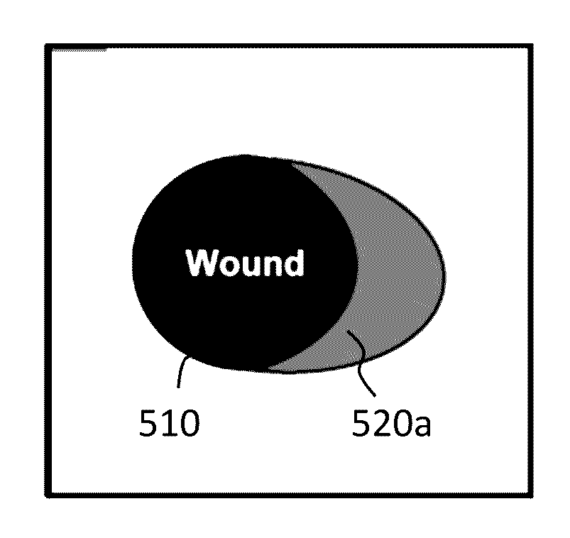 Methods and systems for assessing healing of tissue