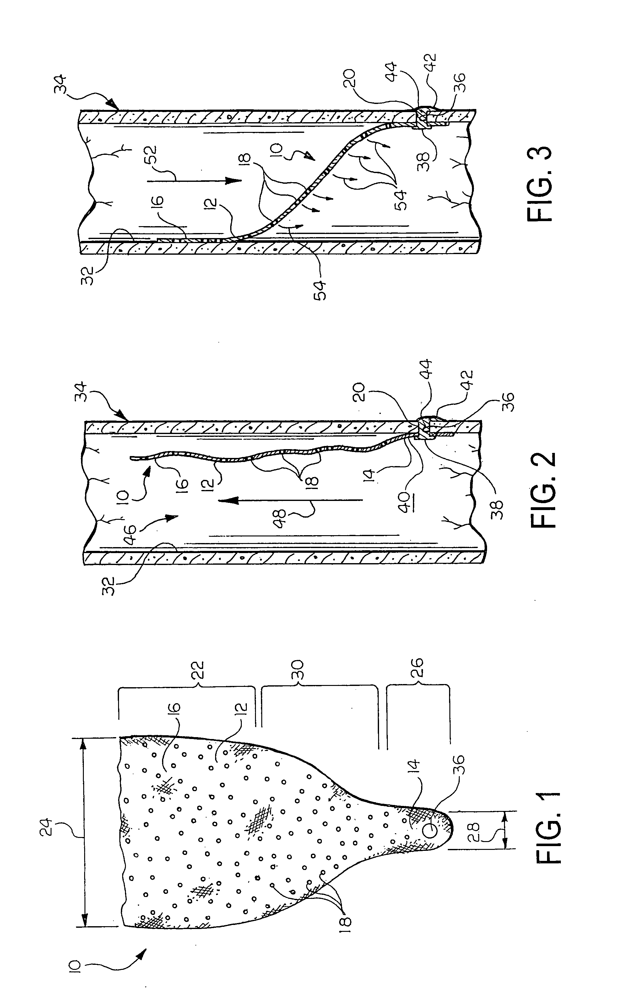 Prosthetic valve with pores