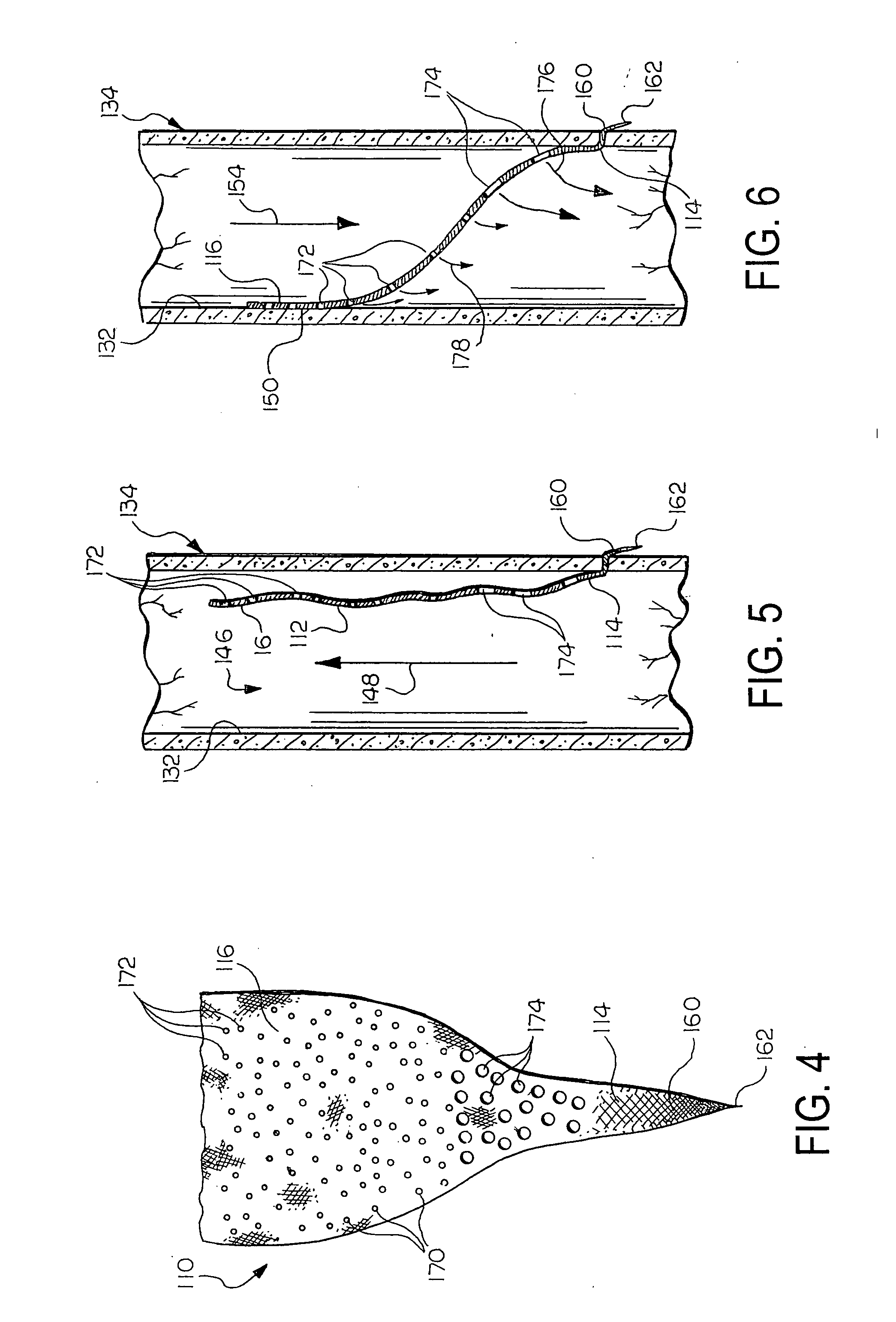 Prosthetic valve with pores