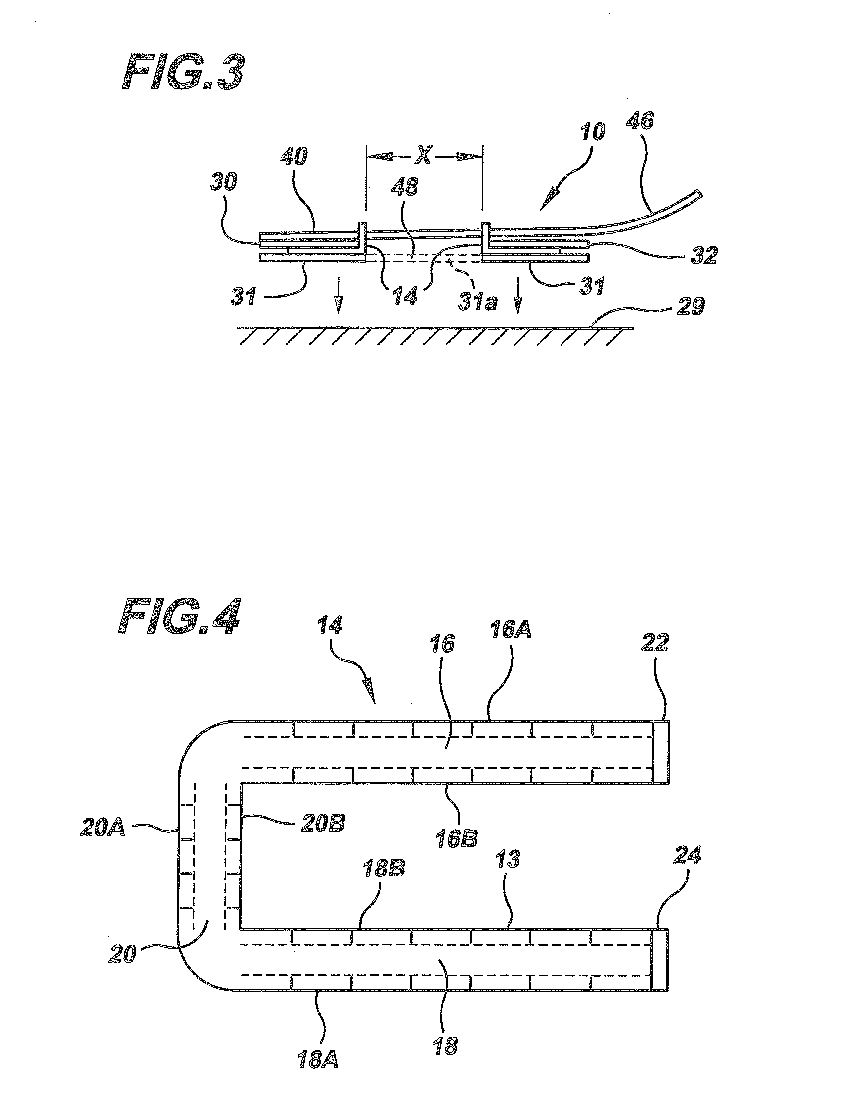 Adjustable non-invasive wound closure system