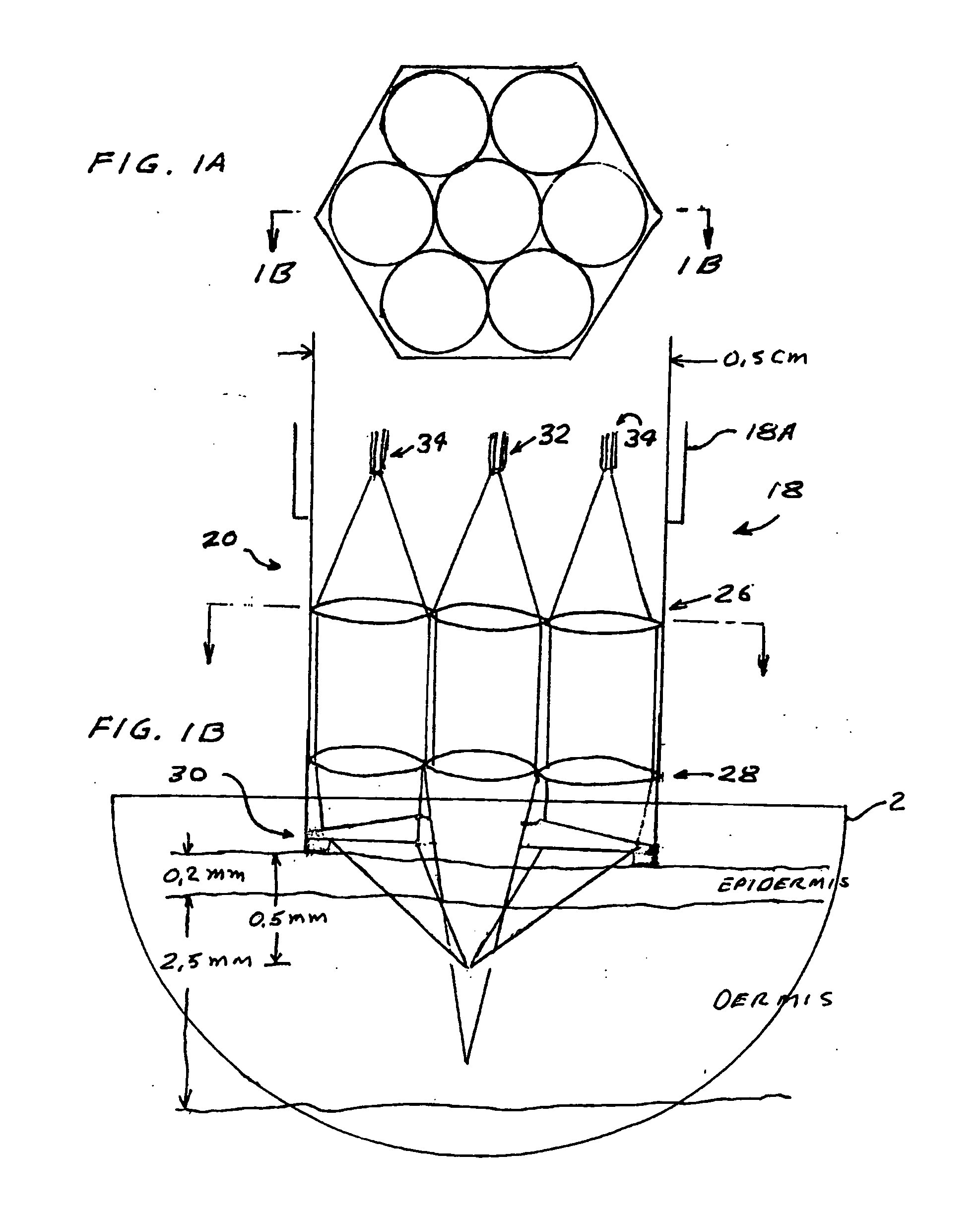 Skin treatement system with time modulated laser pulses