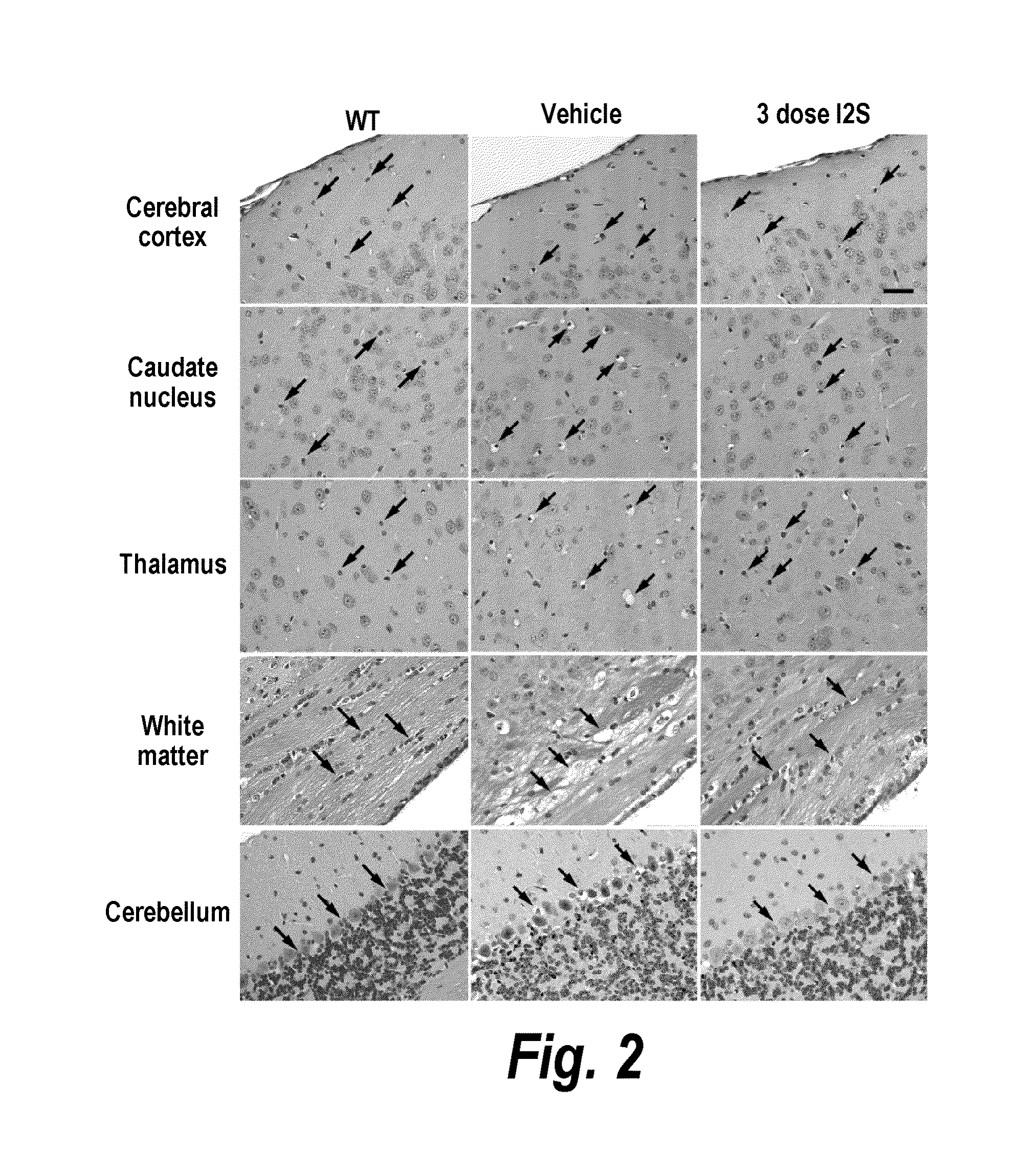 Methods and compositions for CNS delivery of iduronate-2-sulfatase