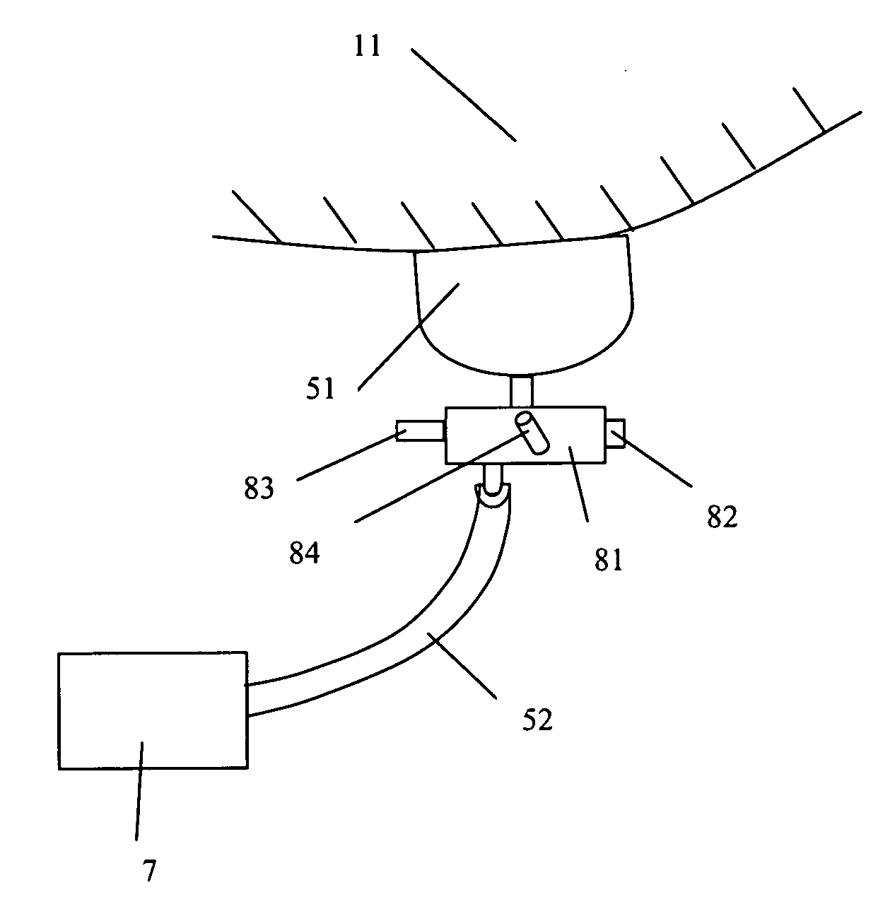 Virtual ports devices and method