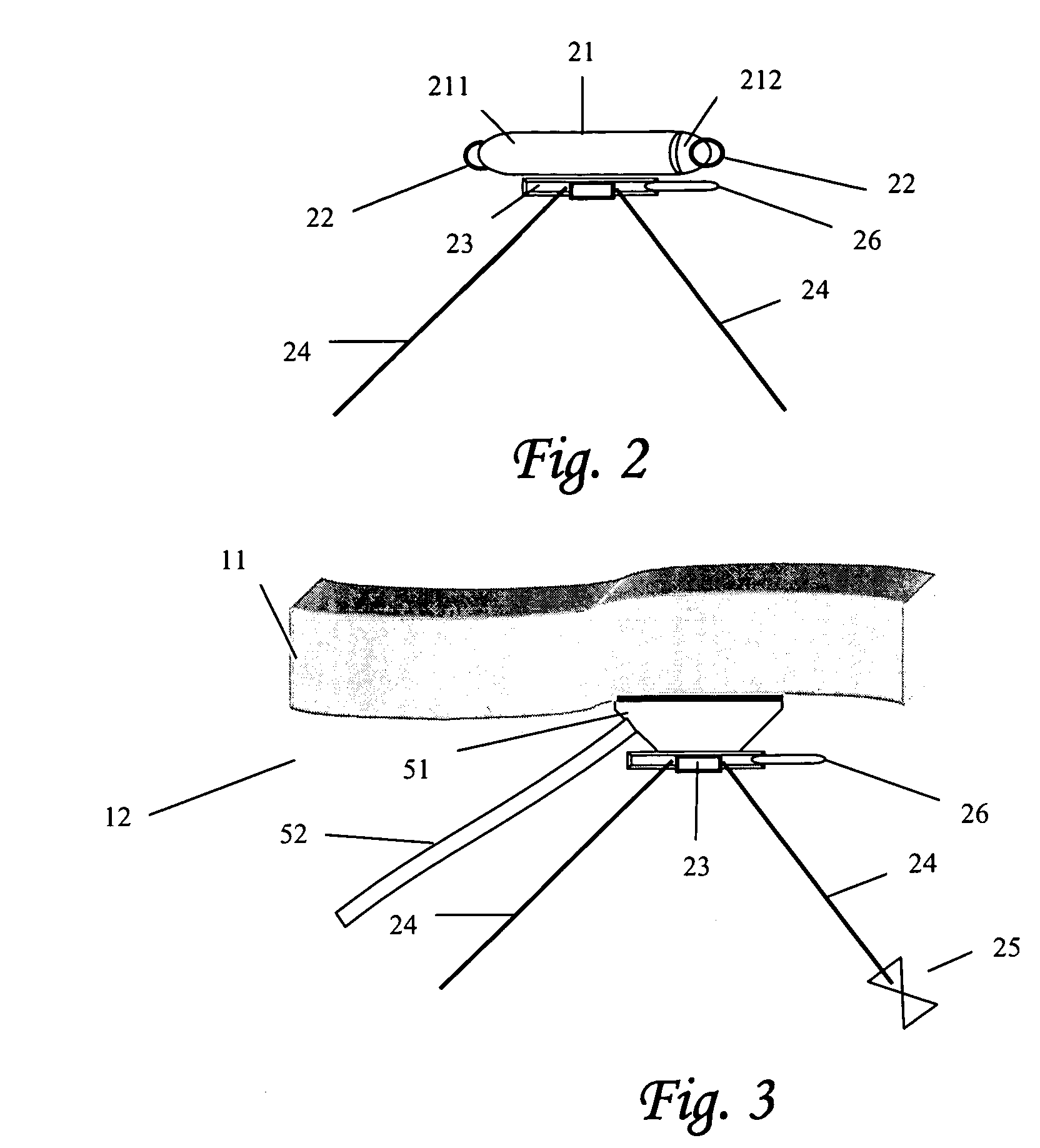 Virtual ports devices and method