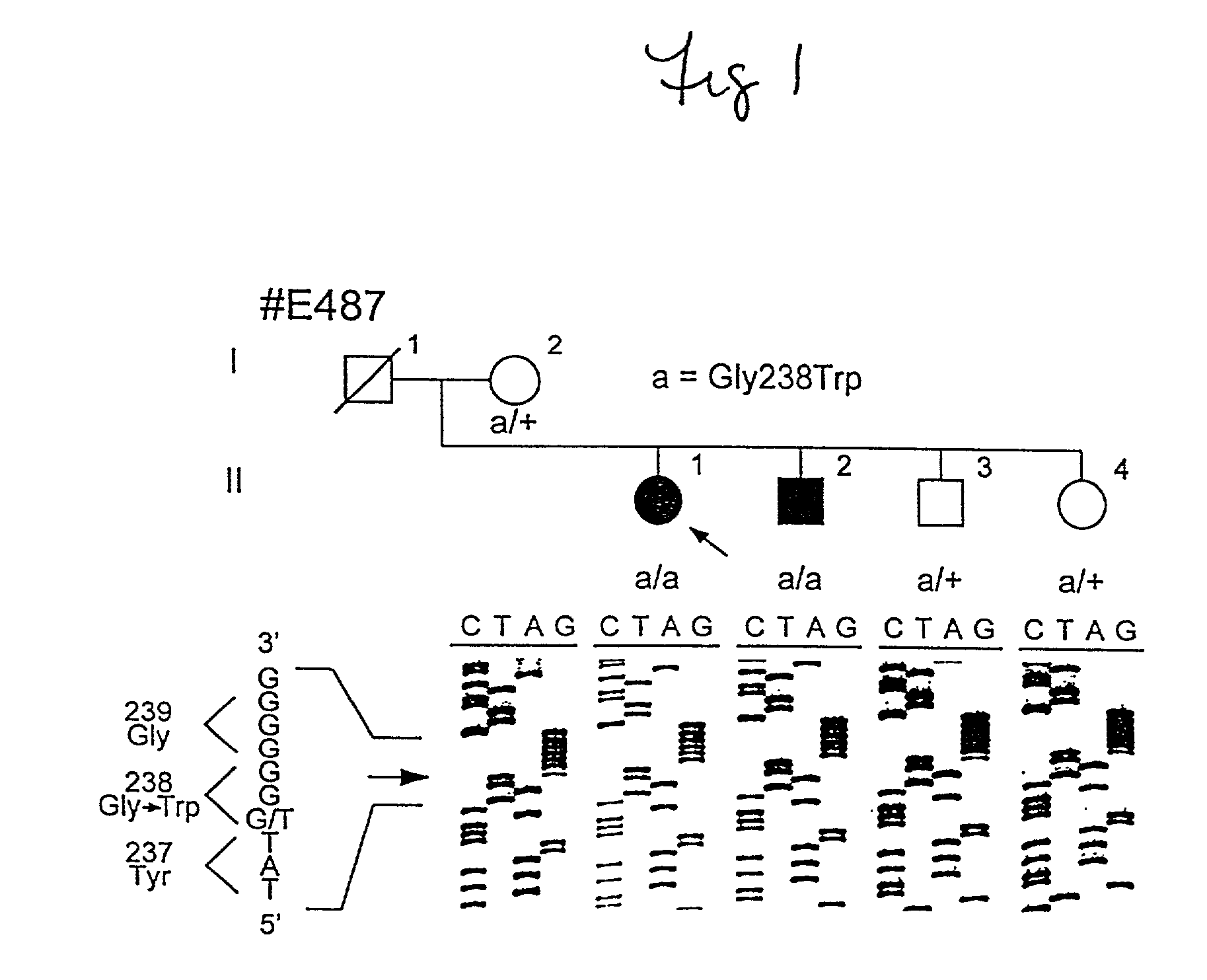 Mutations in nucleic acid molecules encoding 11-CIS retinol dehydrogenase, the mutated proteins, and uses thereof