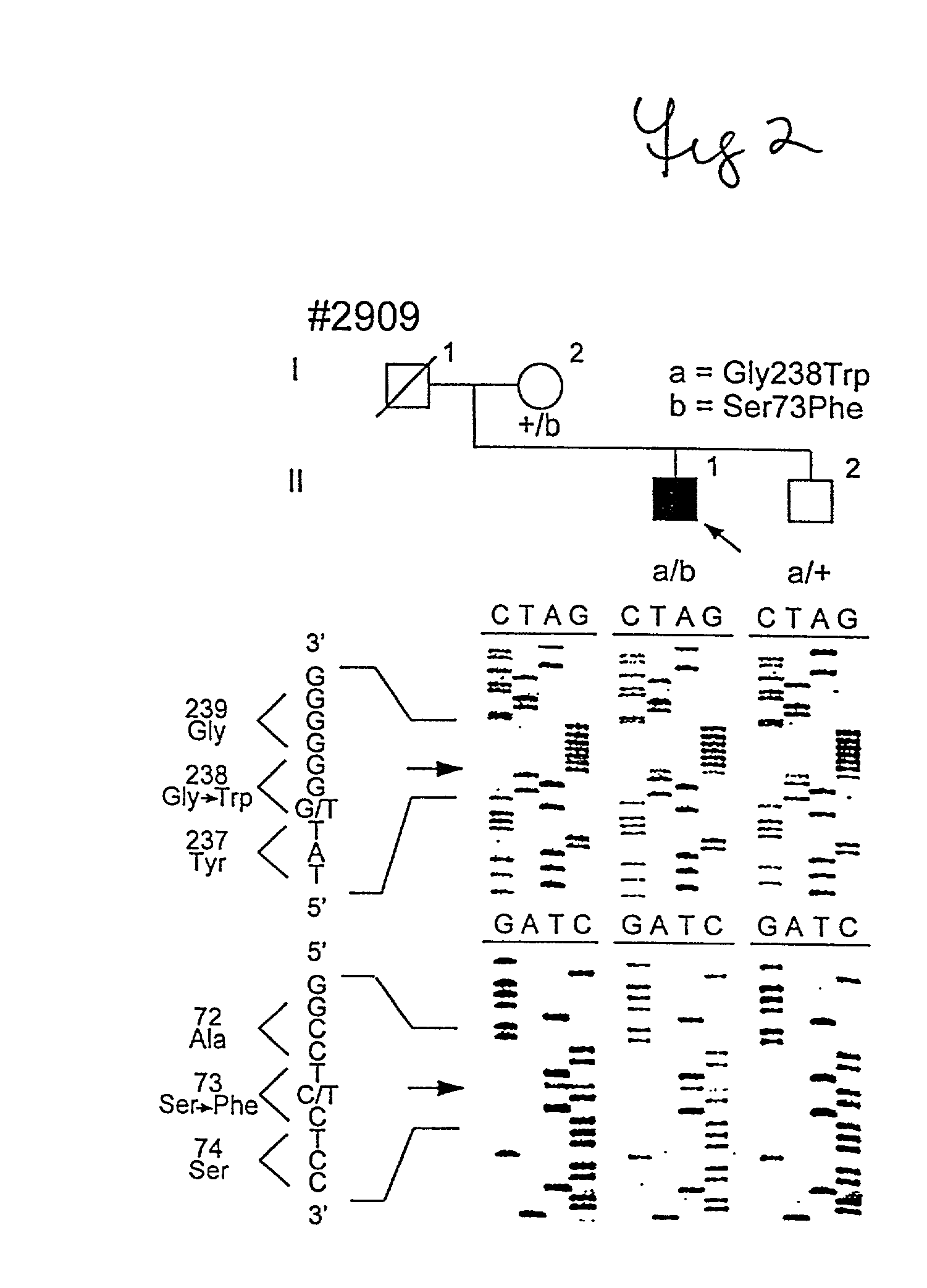 Mutations in nucleic acid molecules encoding 11-CIS retinol dehydrogenase, the mutated proteins, and uses thereof