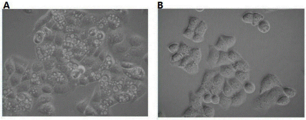 Bacterium AD05 which is separated from human intestinal tract and can generate anti-cancer active metabolites and application of bacterium AD05